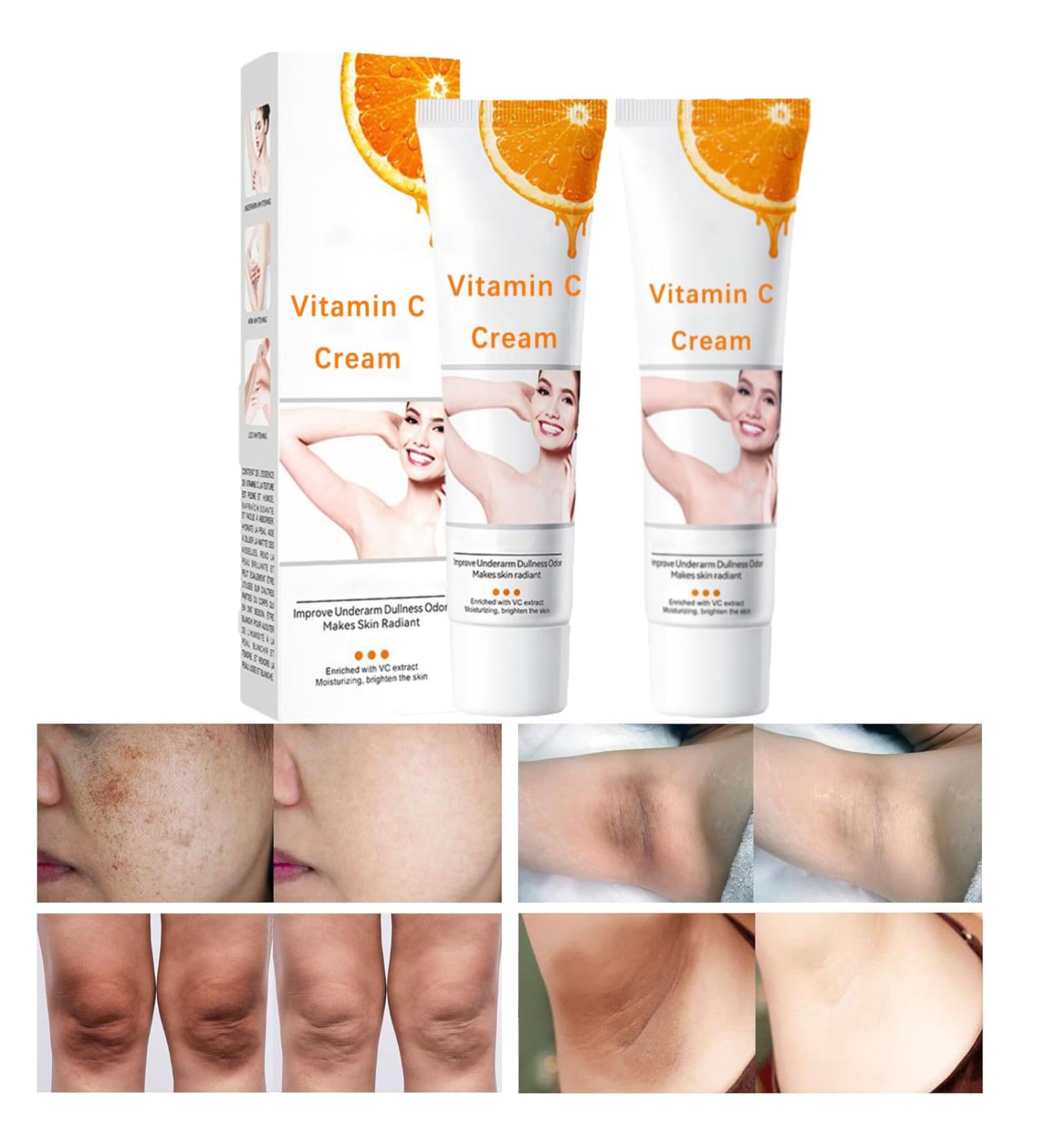 Dark Spot Remover Cream for Intimate Areas & Inner Thighs - Vitamin C Dark Spot Corrector for Body Armpit Knees Elbow - 1.77Oz (2 PCS - Buy Online on GoSupps.com