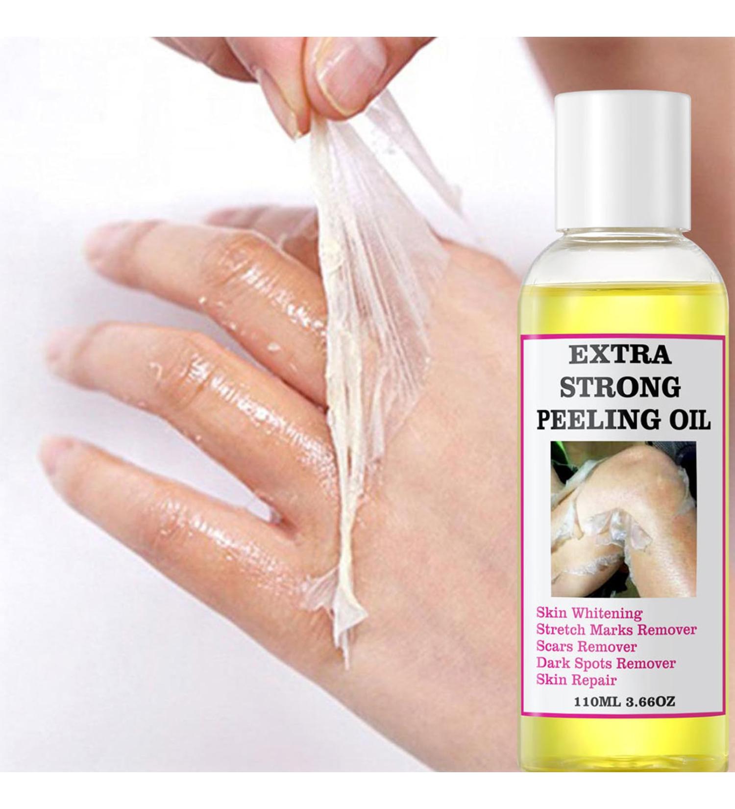 Yellow Peeling Oil - Lightening Exfoliating Dark Skin For Body Strong Peeling Oil Skin Peeling Oil For Skin Lightening Peeling Oil For Skin Brightening Moisturizing Peeling Solution Dark Skin - Buy Online on GoSupps.com