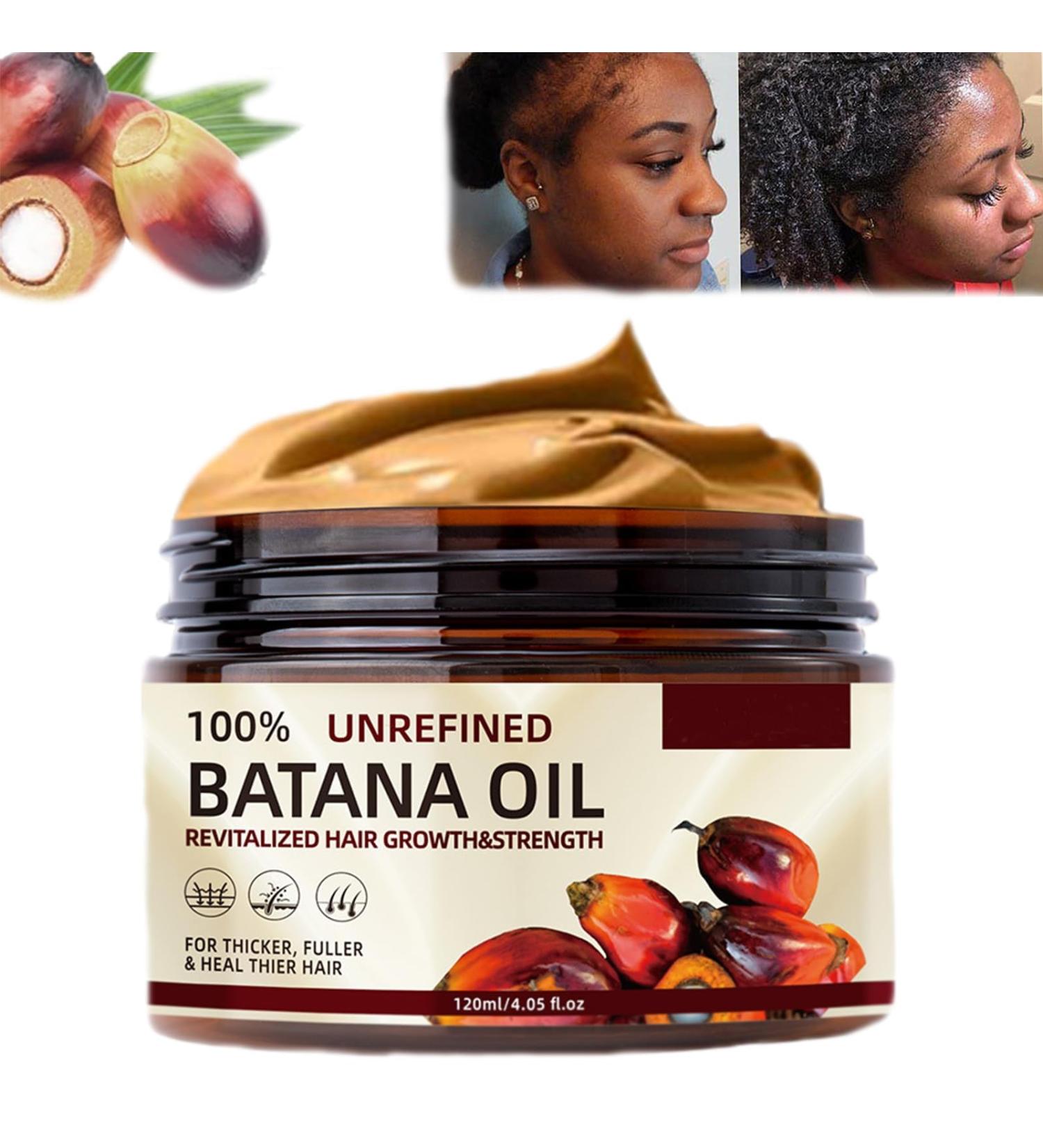 100% Pure Batana Oil for Hair Growth - Organic Raw Miracle Oil from Honduras | Repairs Damaged Hair & Leaves Hair Smoother | 120g - Buy Online on GoSupps.com