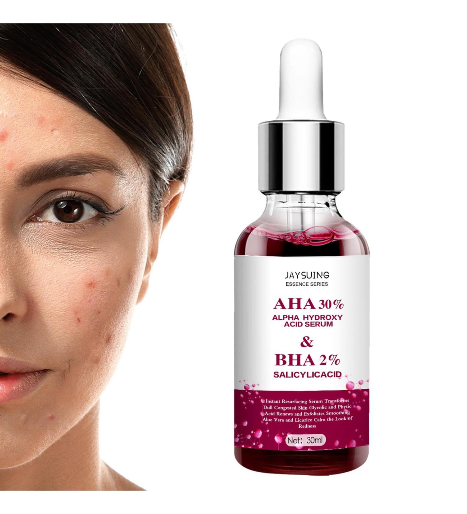 Rosacea Care Rosacea With Natural Moisturizing Fruit Acids Redness Corrector Water Oil Balance Facial Care Improves Skin Relieves Rosacea 30 l - Buy Online on GoSupps.com