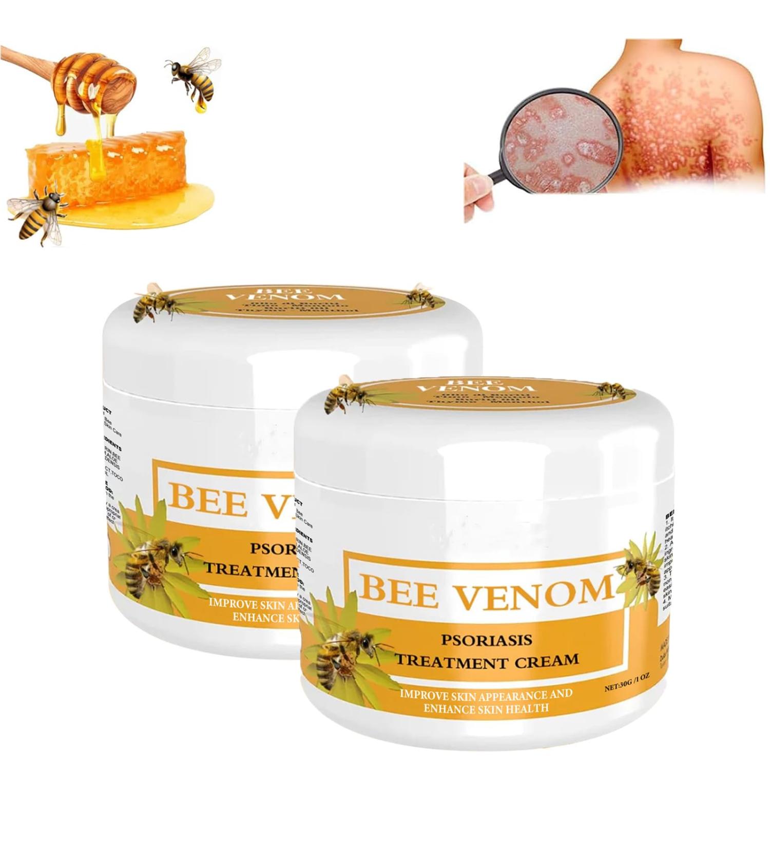 Cvreoz Bee Venom Psoriasis Cream - Effective Psoriasis Treatment with New Zealand Bee Venom (2PC) - International Shipping Available - Buy Online on GoSupps.com