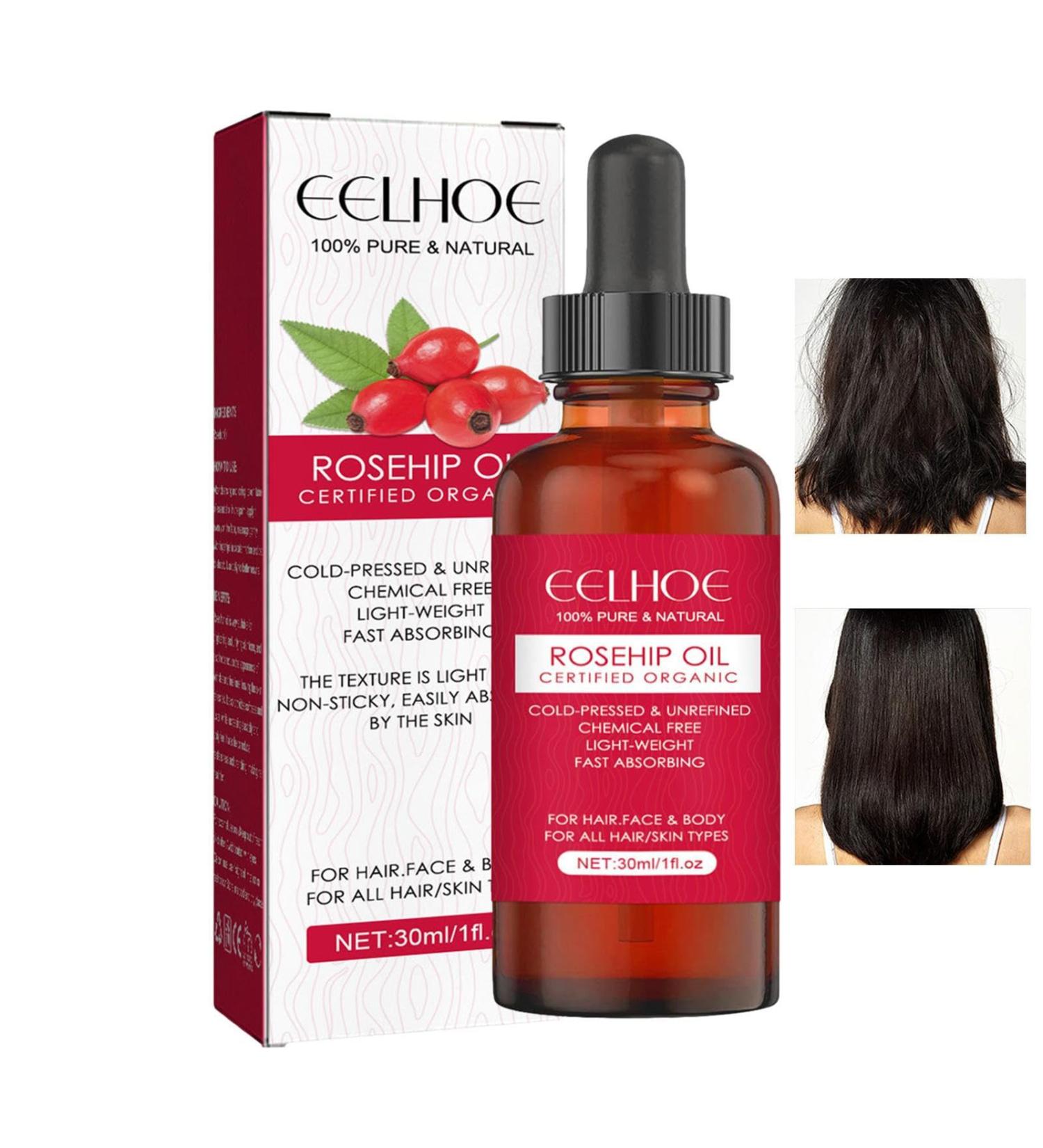 Royal Oil - Pure Natural Rose Hip Kernel Oil 30ml | Moisturizing Skin Care for All Skin Types | Essential Oil for Face Hair & Nails - Buy Online on GoSupps.com