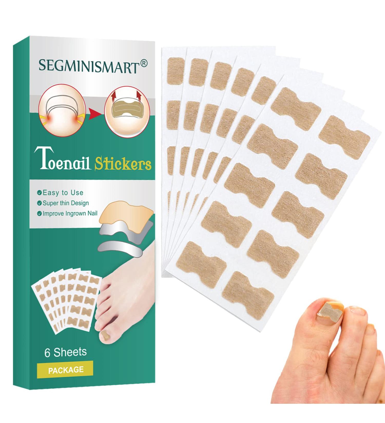 60 Pcs Toenail Correction Patch - Ingrown Toenail Corrector Tools for Perfect Pedicure - Buy Online on GoSupps.com