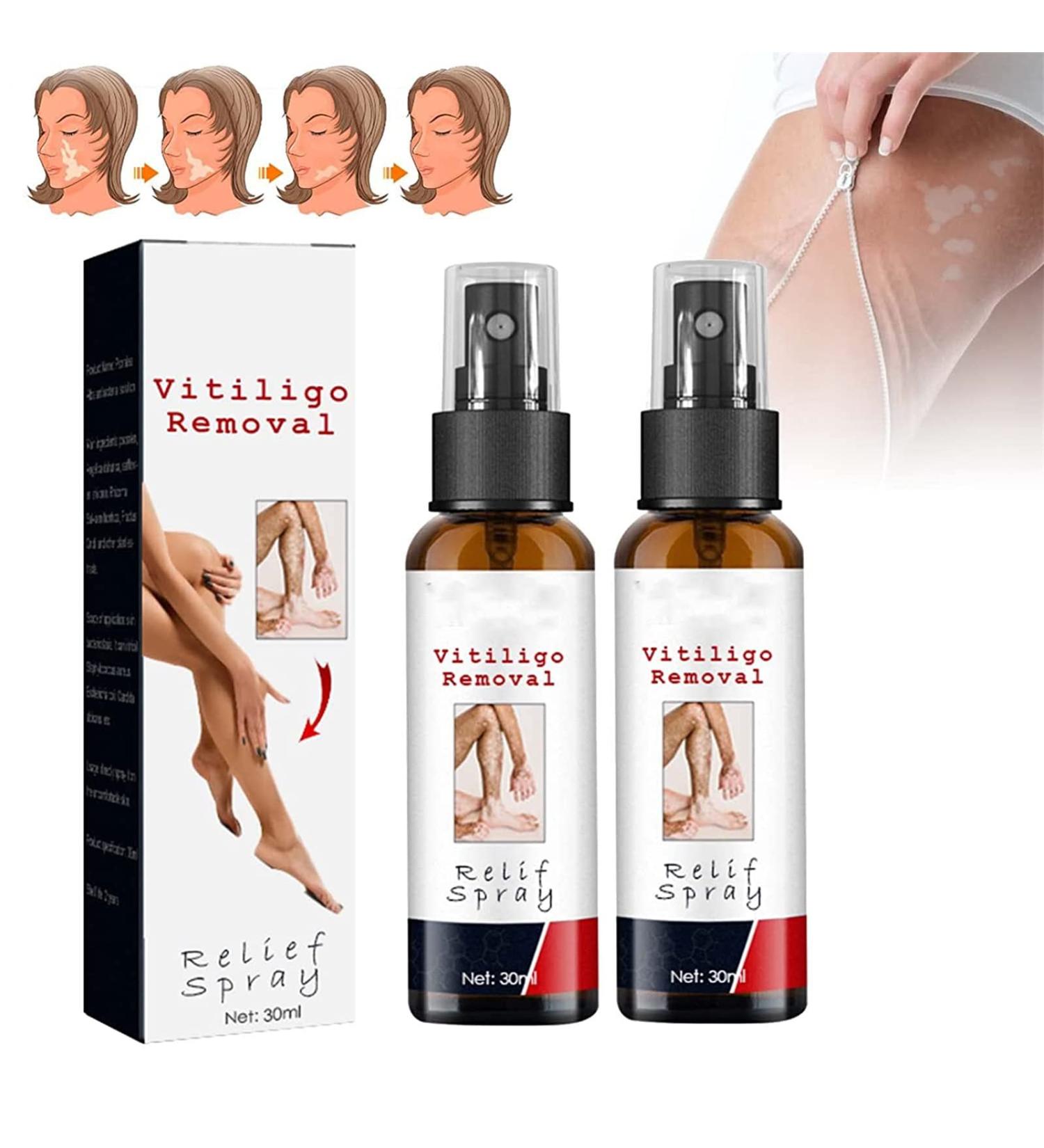 DUBUSH VitiligoRemoval Relief Spray Vitiligo Skin Repair Spray Psoriasis Relief Spray Psoriasis Treatment Spray Soothing and moisturizing Reduces white spots on the skin - Buy Online on GoSupps.com