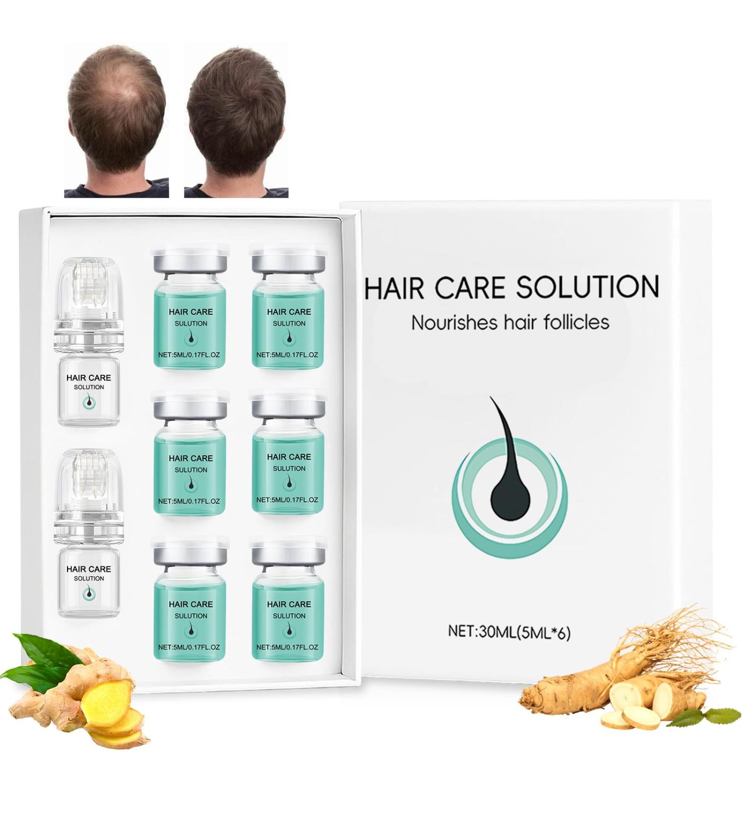 Alpha Infuse Colagea Micro Infuse Cheveux Repousse cheveux Alphainfuse Hair Regrowth System Acc l re La Pousse Des Cheveux Les Fortifie et Nourrit Les Racines (5 ml x 6) - Buy Online on GoSupps.com