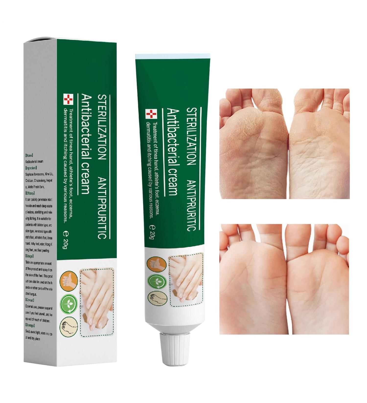 Foot Cream - Nourishing Balm 20g | Hand Lotion For Sensitive Feet Chapped Skin Daily Use Shower Women Men - Buy Online on GoSupps.com