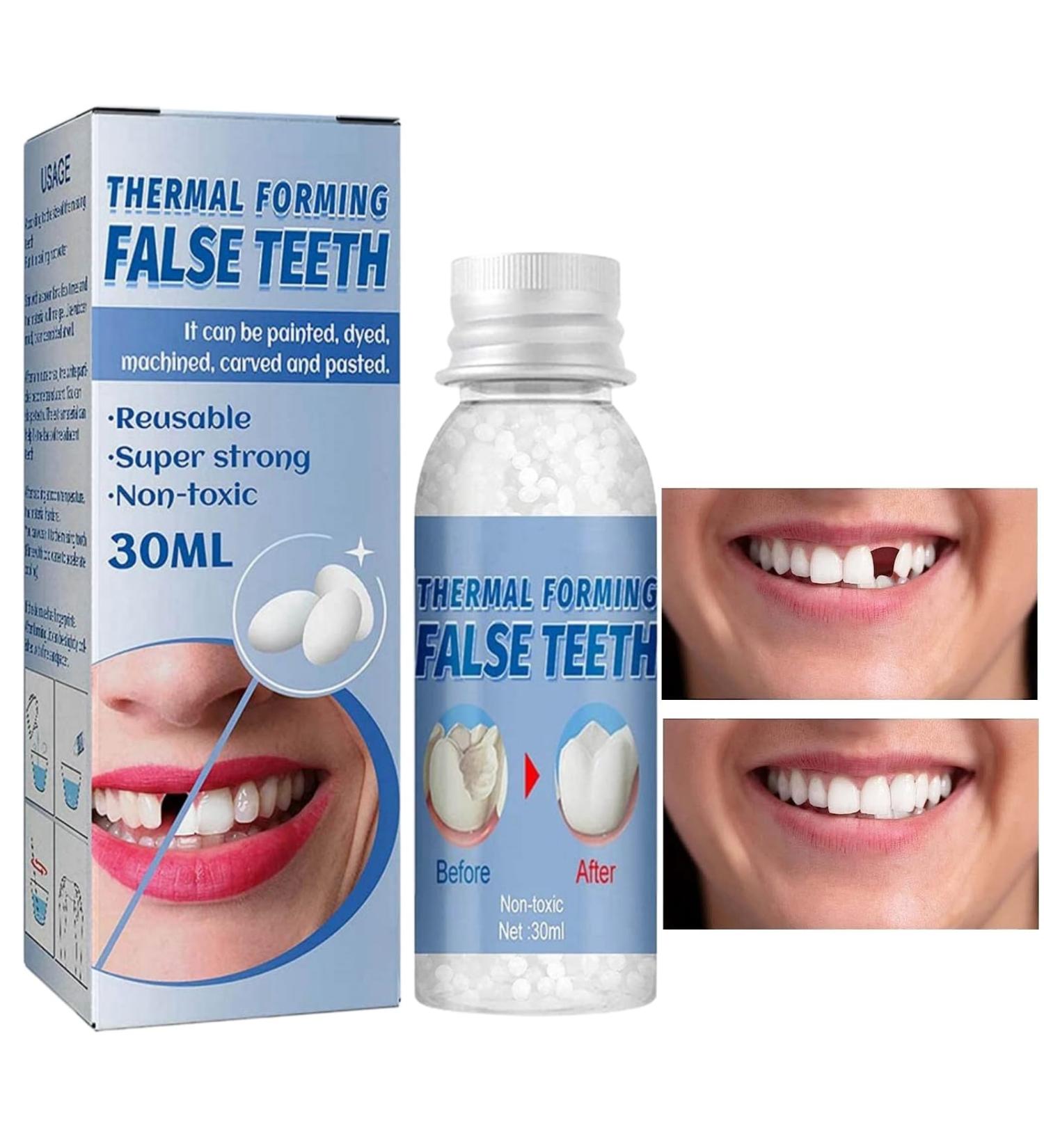 Tooth Filling Repair Kit for Temporary and Broken Teeth - Dental Repair Beads for Dentures and False Teeth - Buy Online on GoSupps.com