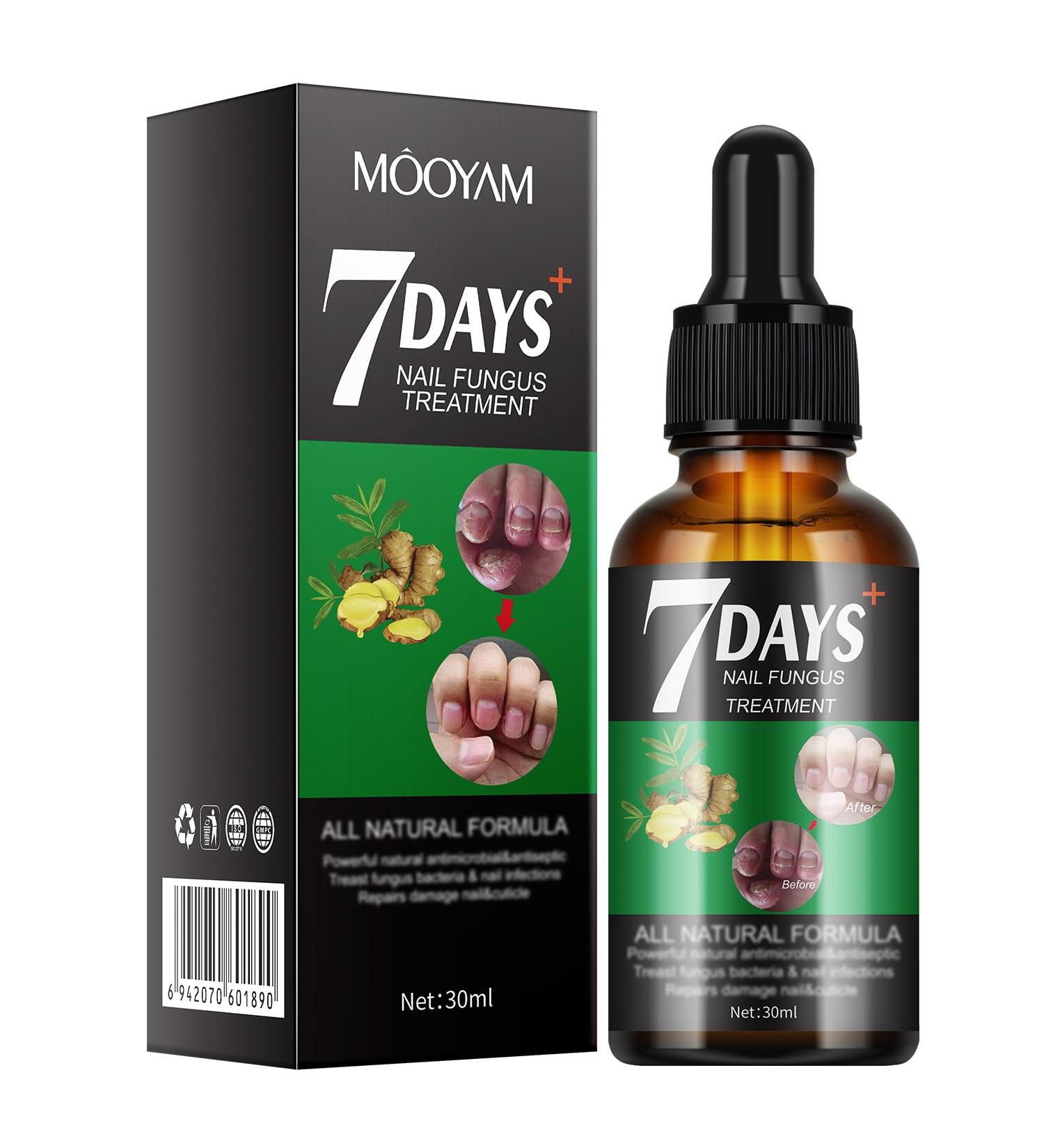 Nail Growth Serum with Ginger Extract - Repair & Strengthen Beautiful Nails | 30ml International Shipping - Buy Online on GoSupps.com