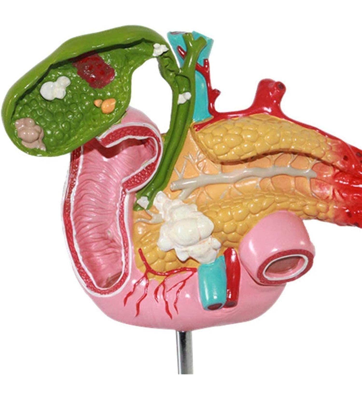 Duodenal Biliary and Pancreatic Model - Duodenal Model - Gallbladder Pathology Digestive System Model Tool Science Teaching Toy Model - Buy Online on GoSupps.com