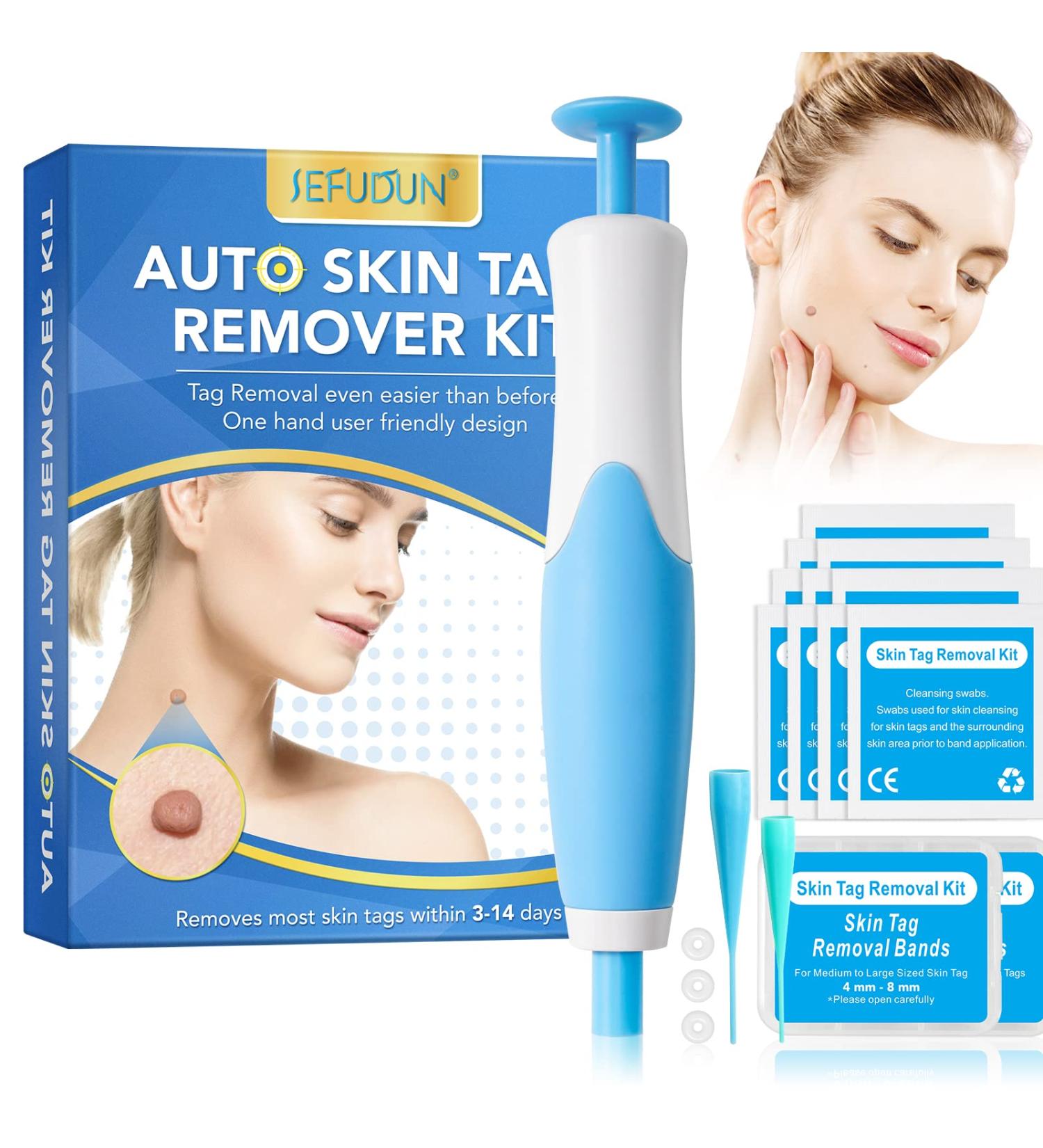 Skin Tag & Wart Remover Kit - Safe & Painless Skin Tag Removal Tool with 40 Bands & 10 Wipes - Blue - Buy Online on GoSupps.com