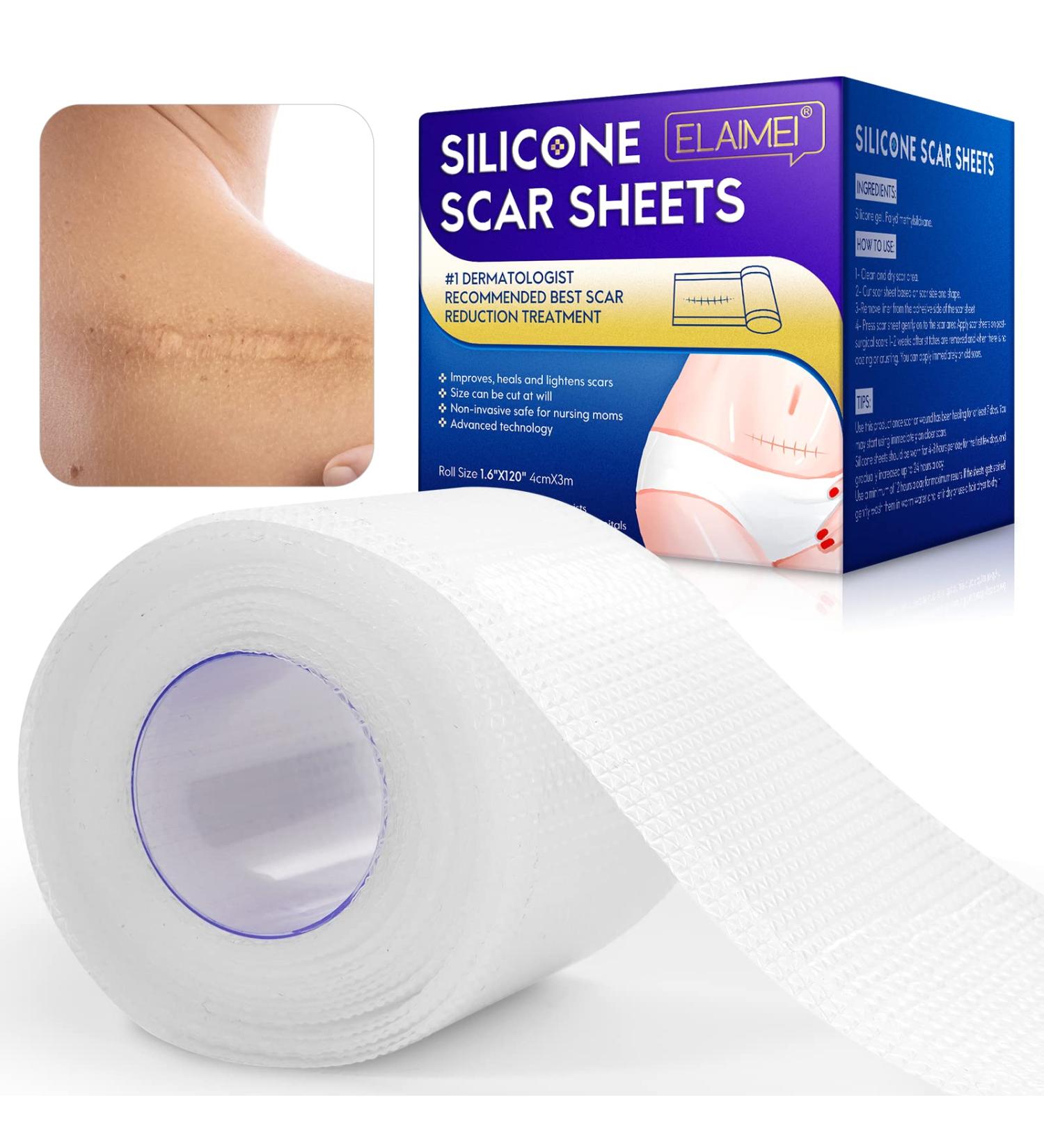 Clear Gel Silicone Scar Tape (1.6'' x 120') for Scar Removal - C-Section Surgery, Keloid, Burn, Acne - Silicone Scar Sheets Strips - Buy Online on GoSupps.com