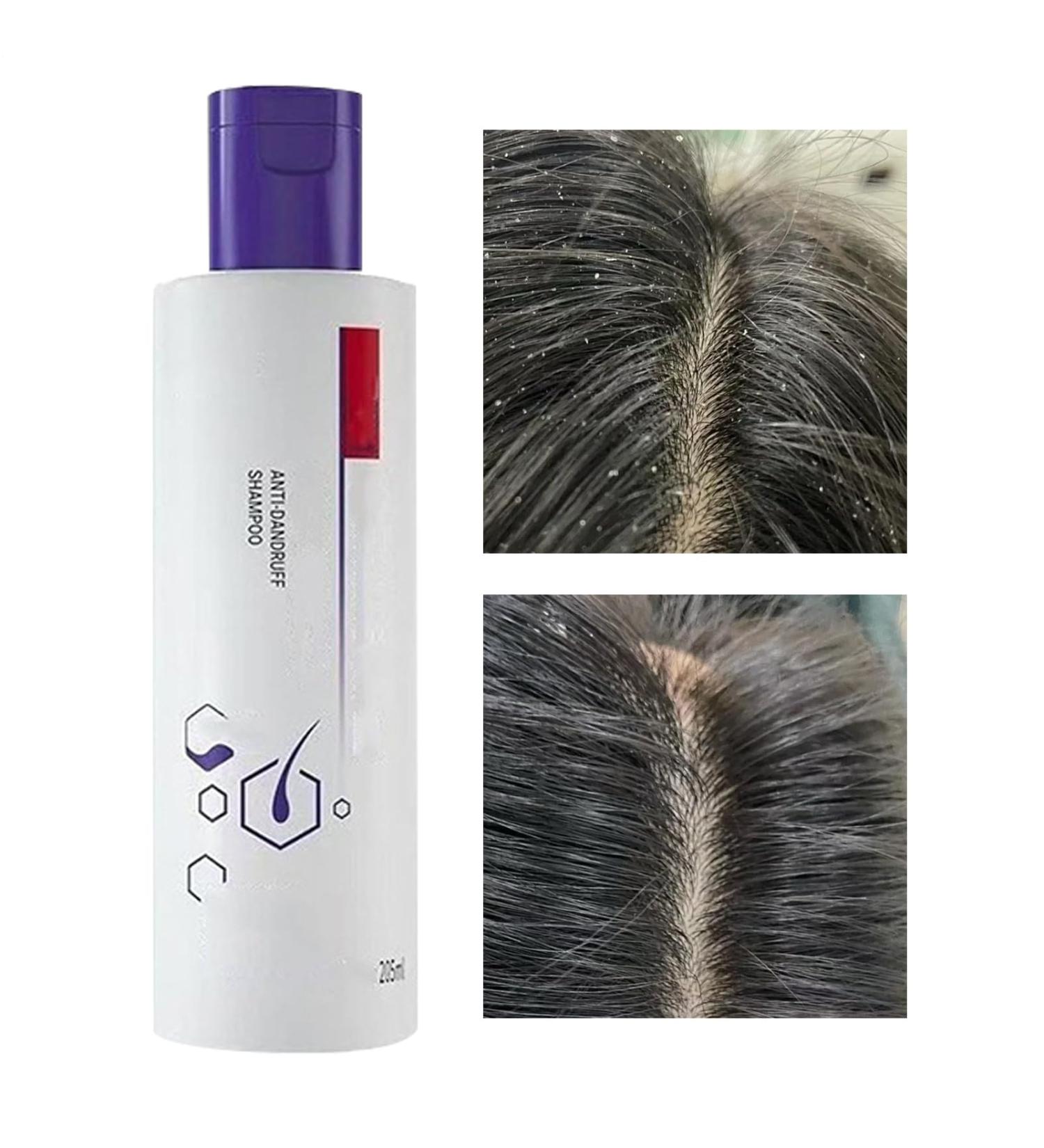  WJnflQN Deep Cleansing Shampoo 205ml Moisturizing Conditioner for Men Balancing Shampoo for Oily Scalp - For Hair Care Travel Home Family and Friends - Buy Online on GoSupps.com