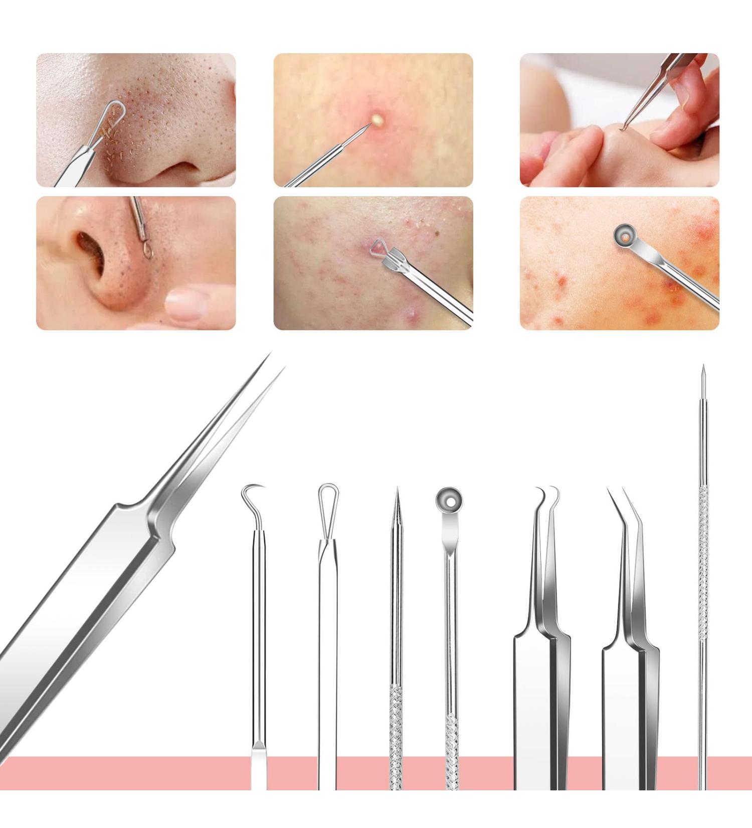 Stainless Steel Blackhead Remover Tool Kit with Metal Case - Acne & Blackhead Extractor Set in Silver Color - Buy Online on GoSupps.com