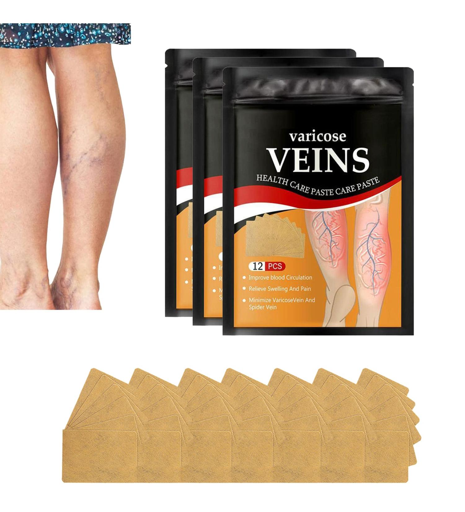 36 Pcs Varicose Veins Patch - Treatment for Legs, Spider Vein Relief - Improve Blood Circulation and Capillary Health - Buy Online on GoSupps.com