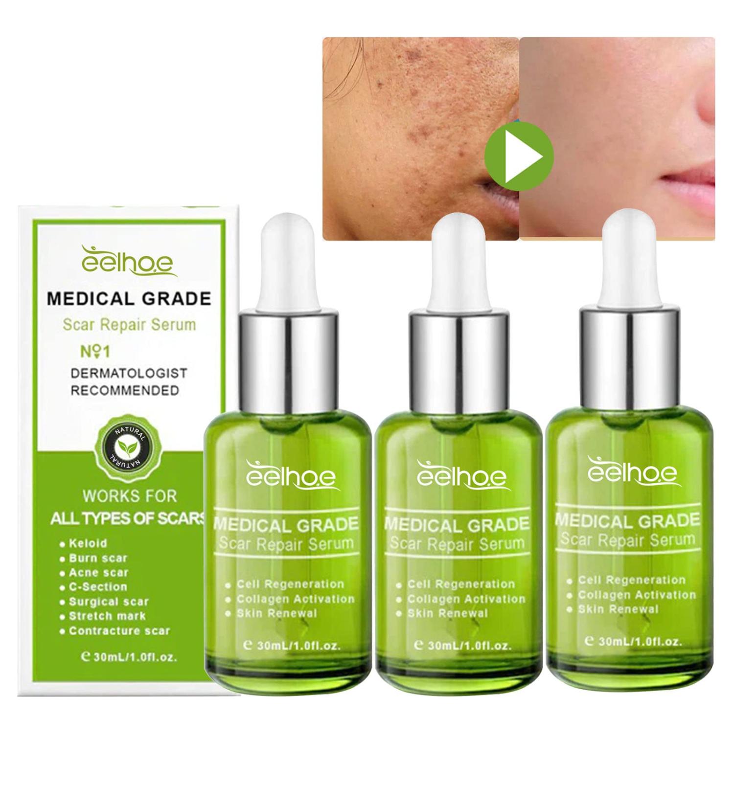Goopgen Advanced Scar Repair Serum - Medical Grade Scar Removal Spray (90ml) - Buy Online on GoSupps.com