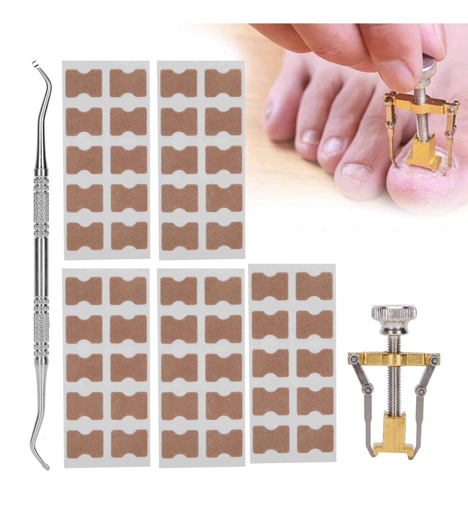 Ingrown Toenail Treatment Ingrown Toenail Corrector Ingrown Toenail Correction Patch Fixer Pedicure Toenail Correction Patch Sticker Foot Care Tool Ingrown Toenail Corrector Strips Foot Care Kit - Buy Online on GoSupps.com