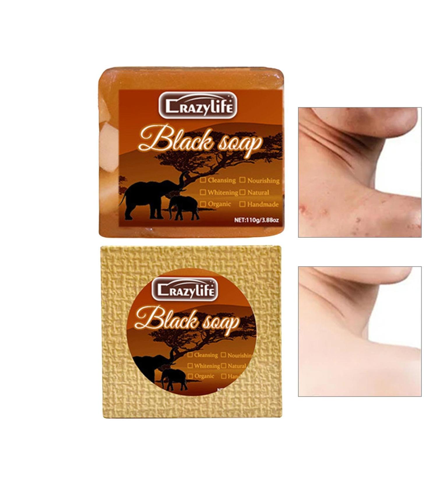  Zankie Facial Cleansing Soap - Skin Gentle Body Scrubs 3.8oz for Women Shea Butter Body Scrubs Woman Exfoliating Body Scrub Non-Greasy Friendly Zankie - Buy Online on GoSupps.com