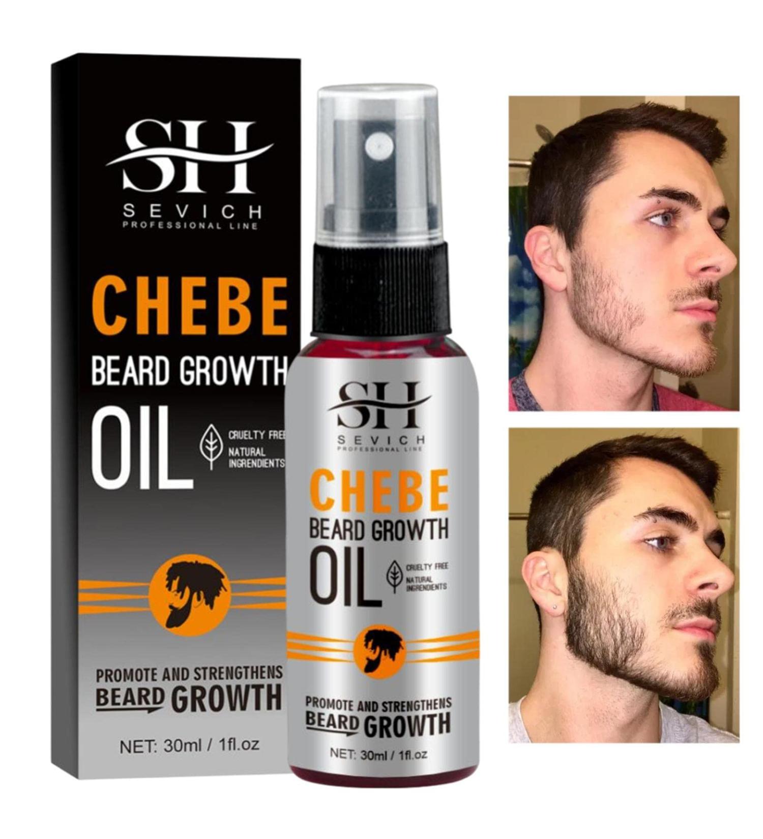 Bartwuchs Oil - Premium Moisturizing Beard Conditioning Oil | 1 fl. oz | Softens & Strengthens Beards & Mustaches for Men - Buy Online on GoSupps.com