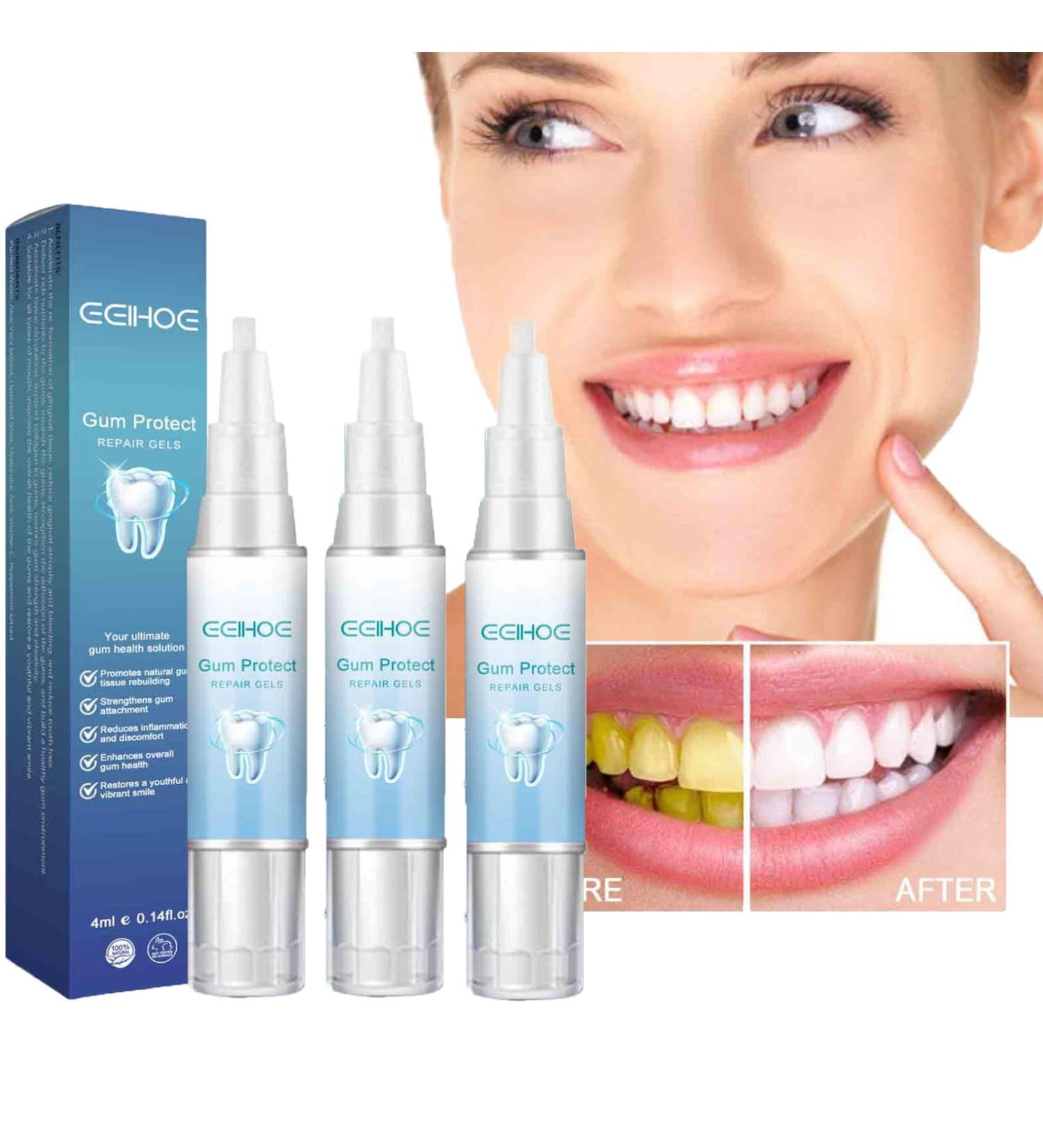 Teeth Whitening Abbey - Gums Therapy Gel & Tooth Elevator Essence Pen Set (3 PCs) - Instant Gum Treatment & Rejuvenation - Buy Online on GoSupps.com