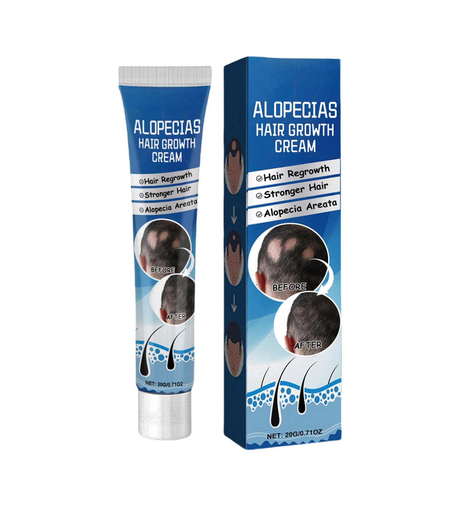 Alopecia Cr me de croissance des cheveux p te capillaire naturelle cr me paississante des cheveux formule naturelle pratique compacte 20 g pour homme et femme adulte - Buy Online on GoSupps.com