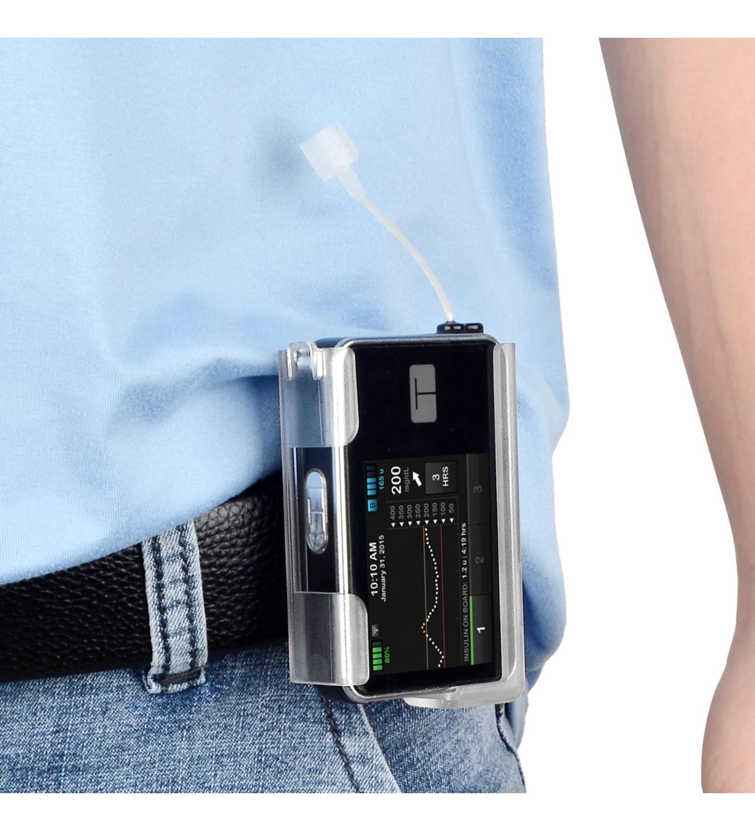 iGuerburn 360 Rotating Case for Tandem tslim X2 Insulin Pump Holder - Clear - Buy Online on GoSupps.com