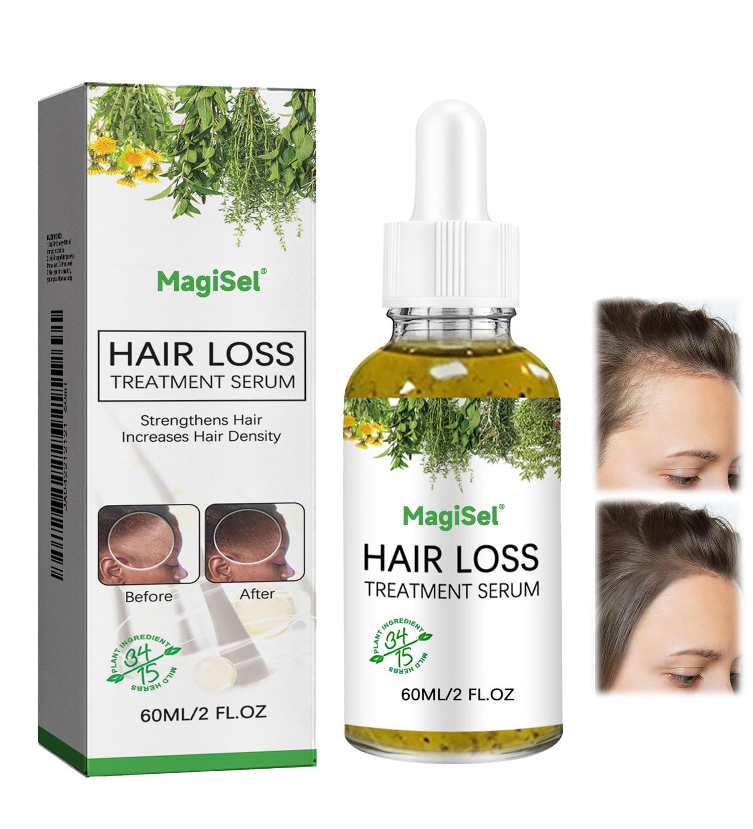 MagiForeign Hair growth serum rosemary oil accelerates hair growth with rosemary for hair growth oil massage the scalp to care for the hair prevents hair loss for men and women 60 ml - Buy Online on GoSupps.com