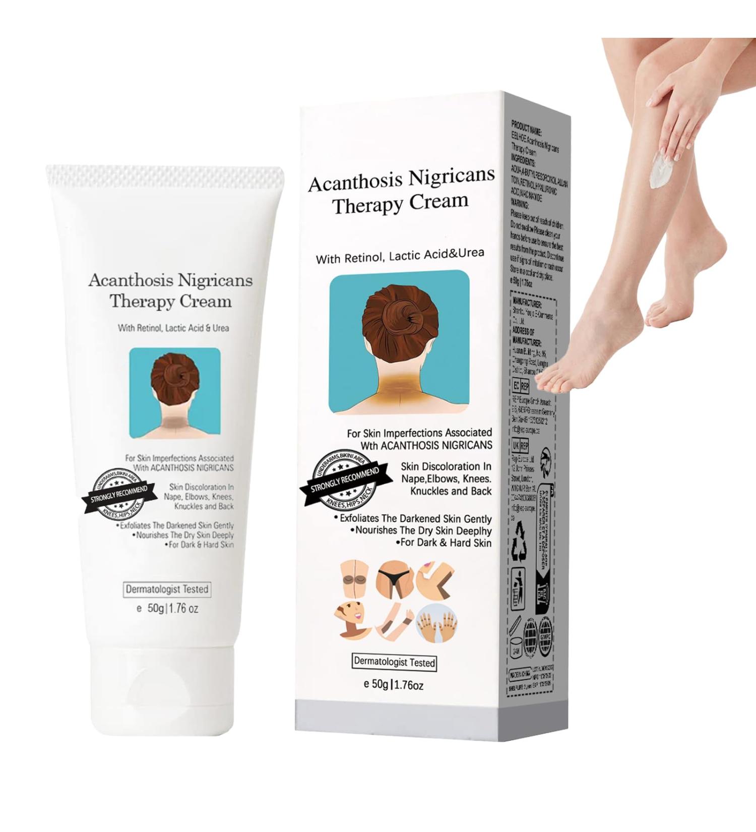 14 cream against dark spots 50 g acanthosis Nigricans cream Acanthosis Nigricans therapy cream armpit whitening cream removes hyperpigmentation for dark body parts - Buy Online on GoSupps.com