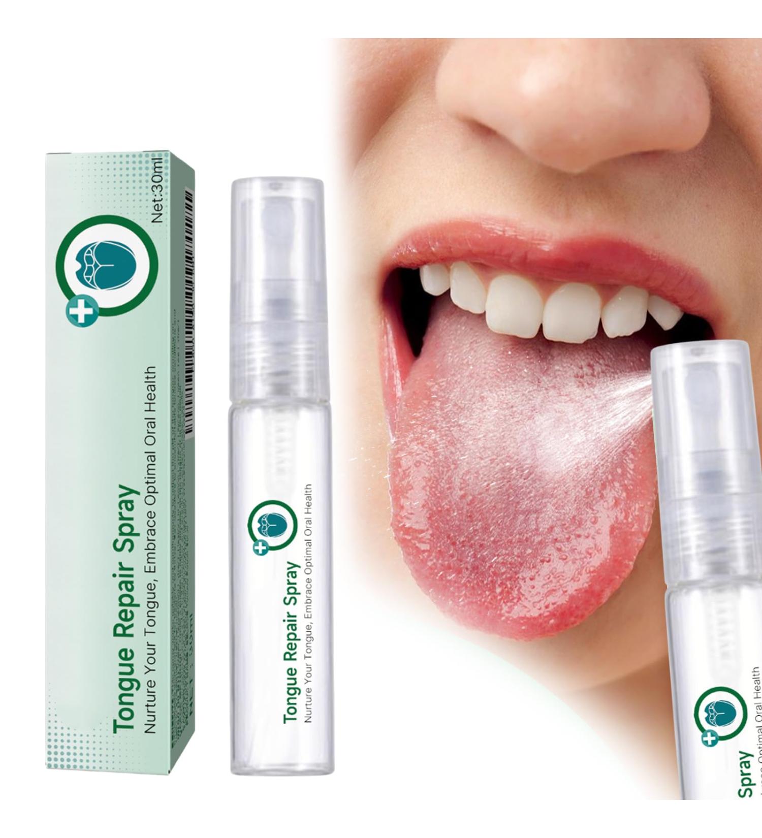 Spray Buccal Protection Spray de R paration de Langue Spray De Soulagement de Langue Langue Spray pour Mauvaise Haleine Spray Rafra chissant pour L'haleine Spray R paration Langue - Buy Online on GoSupps.com