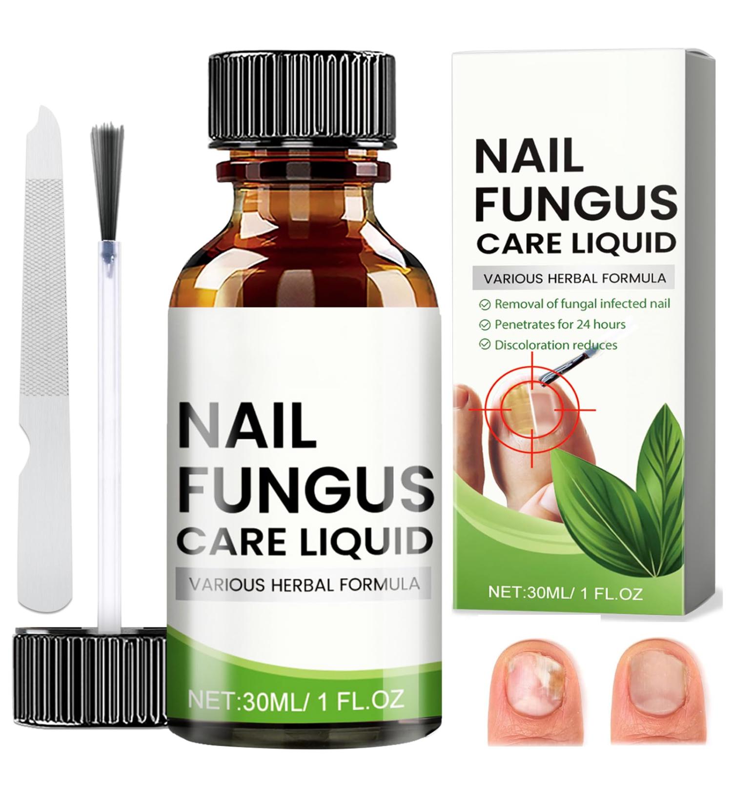  Sikeydels Foot Nail Care Nourish and Soothe Nails Strengthens Nail Structure Nail Treatments with 1 Nail File 30ml - Buy Online on GoSupps.com