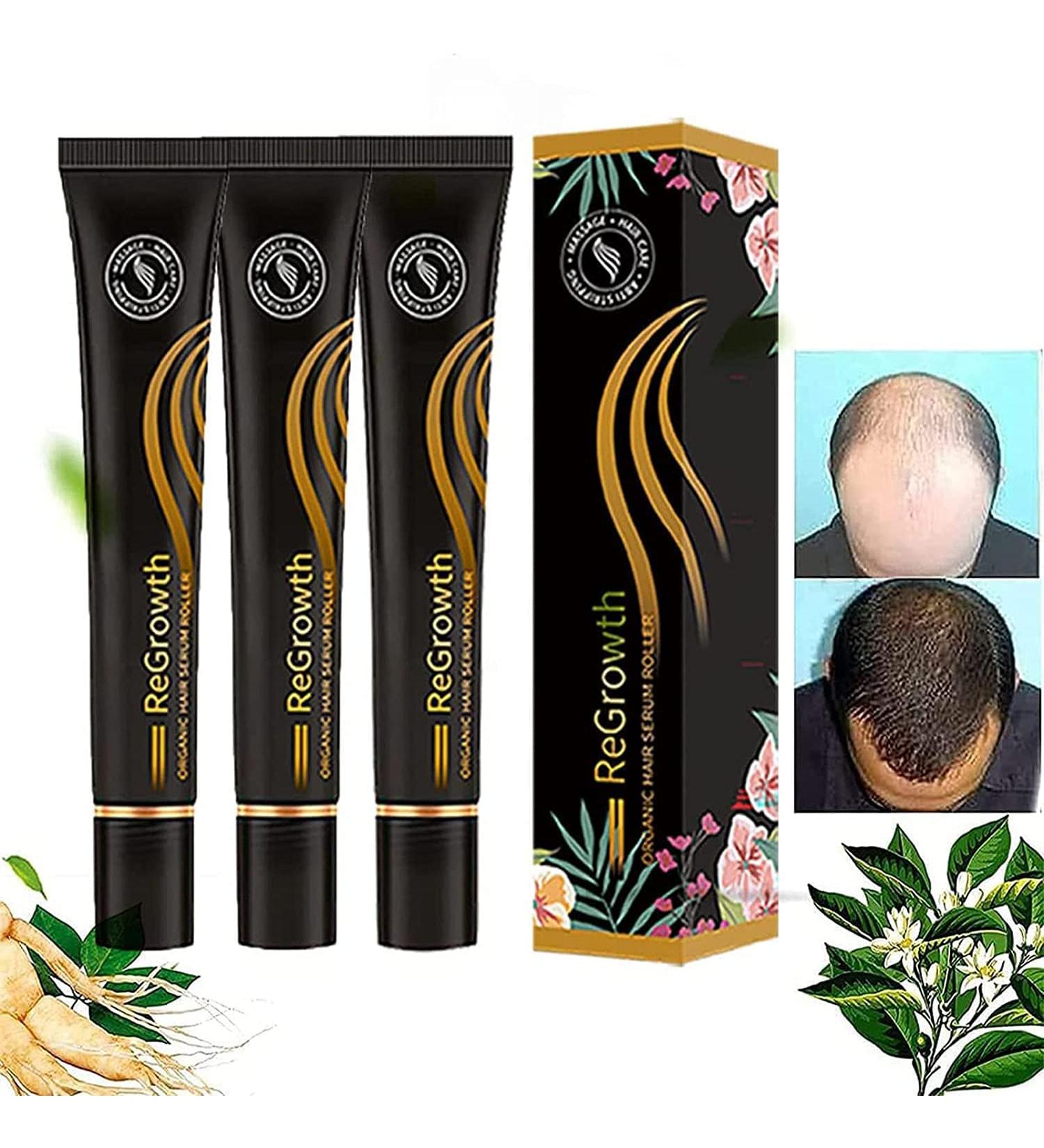 Regrowth Organic Hair Serum | 3PCs Anti-Hair Failure Treatment | Triple Roll-On Hair Growth Essence for Men & Women - Buy Online on GoSupps.com
