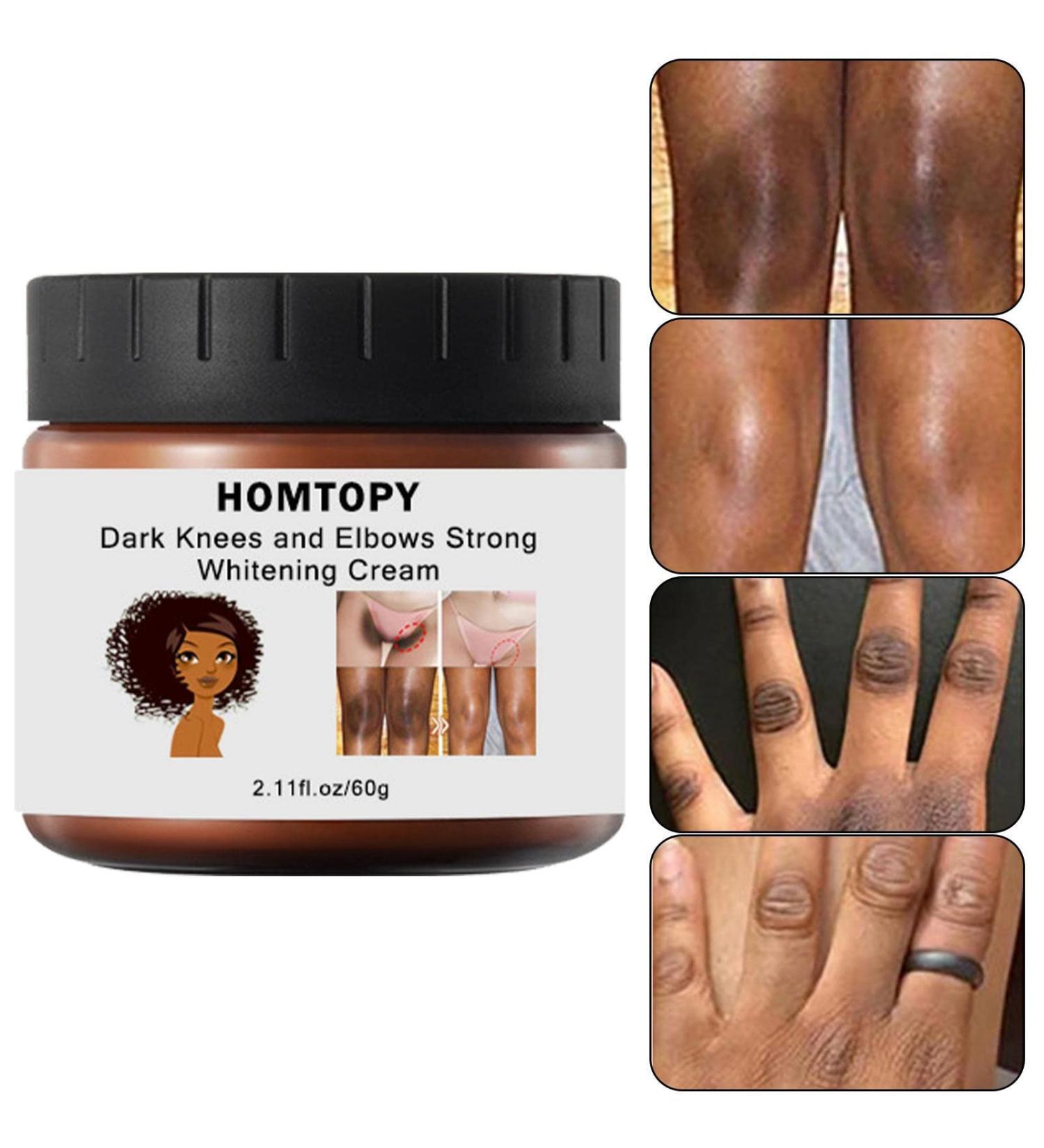  Linsition Underarm lightening intimate lightening bleaching cream for private areas skin lightening bleaching cream dark spot remover for the - Buy Online on GoSupps.com