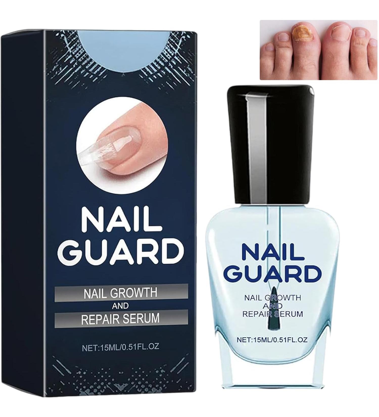 Onyxoguard Nail Growth and Repair Serum Nail Growth Serum Nail Strengthening and Growth Conditioner Nail Strengthener Oil for Damaged Nails Conditioning Nail Care for Weak Thin Nails (1Pcs) - Buy Online on GoSupps.com