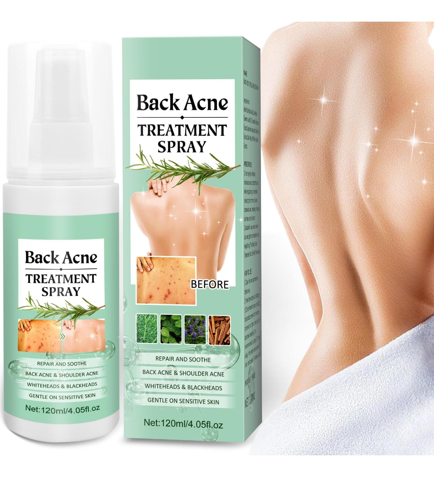 Back Acne Treatment Spray With Herbal Formula 2% Salicylic Acid & Tea Tree Oil - Body Acne Solution 120ml 1PCS - Buy Online on GoSupps.com