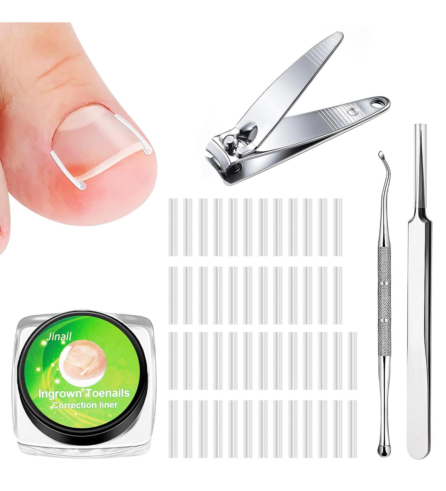 152-Piece Ingrown Toenail Tool Set & Correction Patch for Ingrown Toenails - International Shipping Available - Buy Online on GoSupps.com
