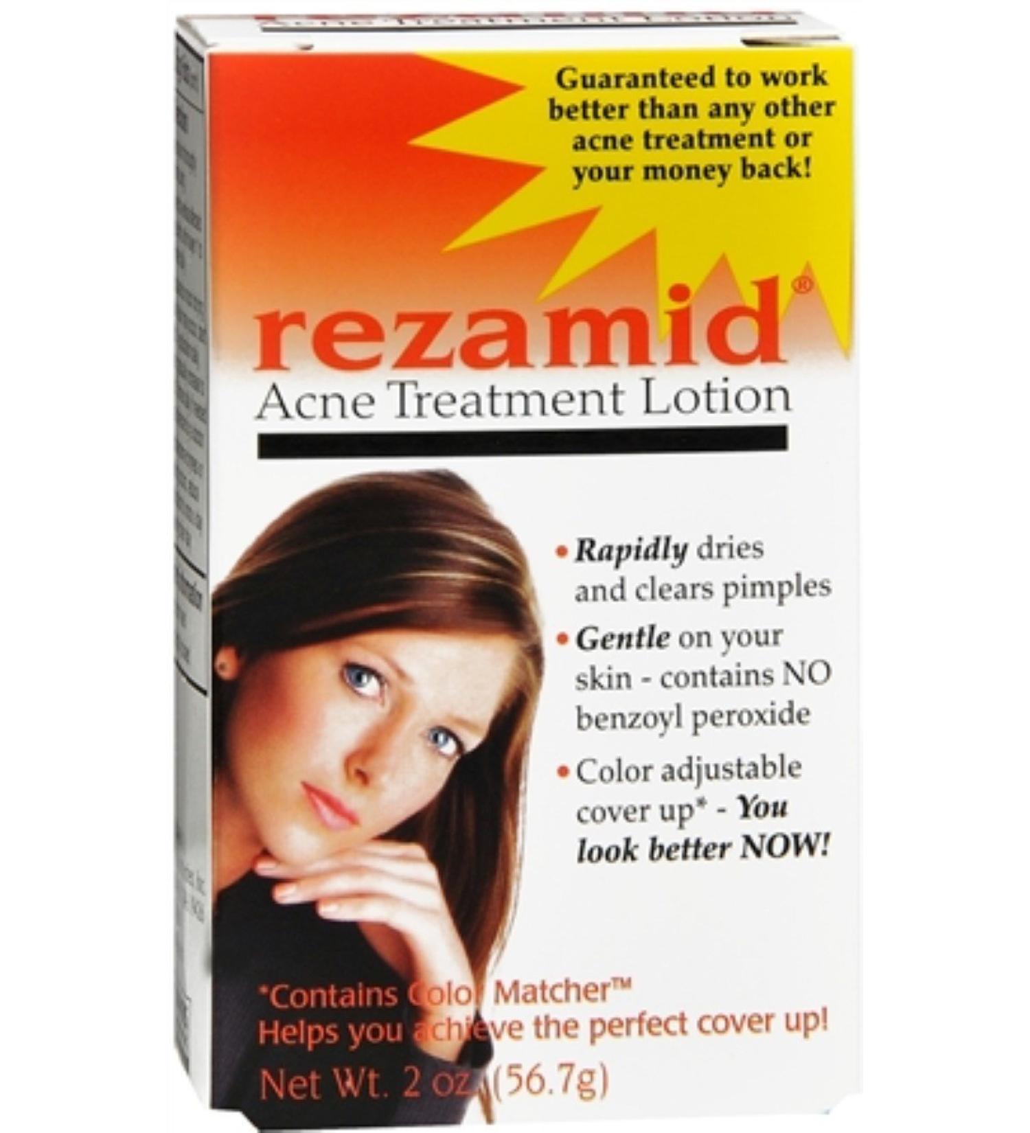 Acne Treatment Lotion 2 oz (Pack of 2)