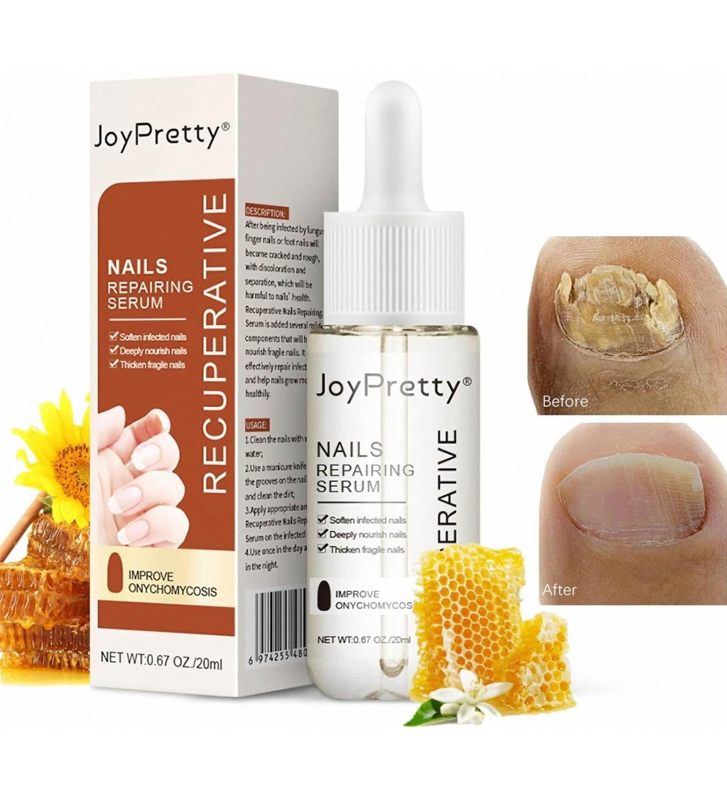 ILOVMUP Nail Cuticle Oil Nail Treatment for Dry & Damaged Nails Cuticle Care Oil for Fungal Nail & Toenails Strength Nail Oil for Moisturizing and Repairing Cracked Nail - 20ml - Buy Online on GoSupps.com