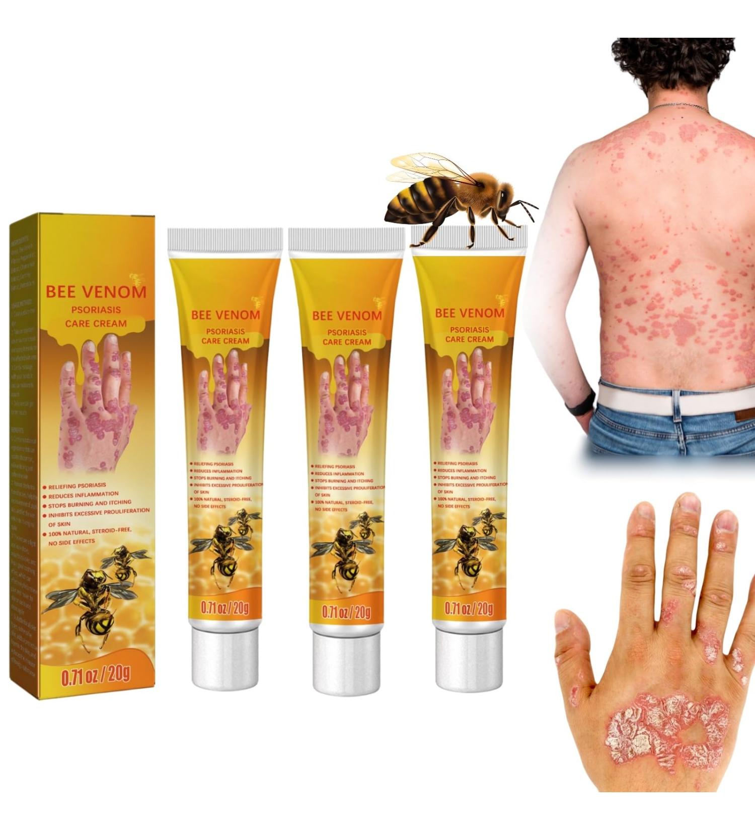 Bee Venom Psoriasis Treatment Cream - Soothing and Moisturizing Skin Relief - 3PCS - Buy Online on GoSupps.com