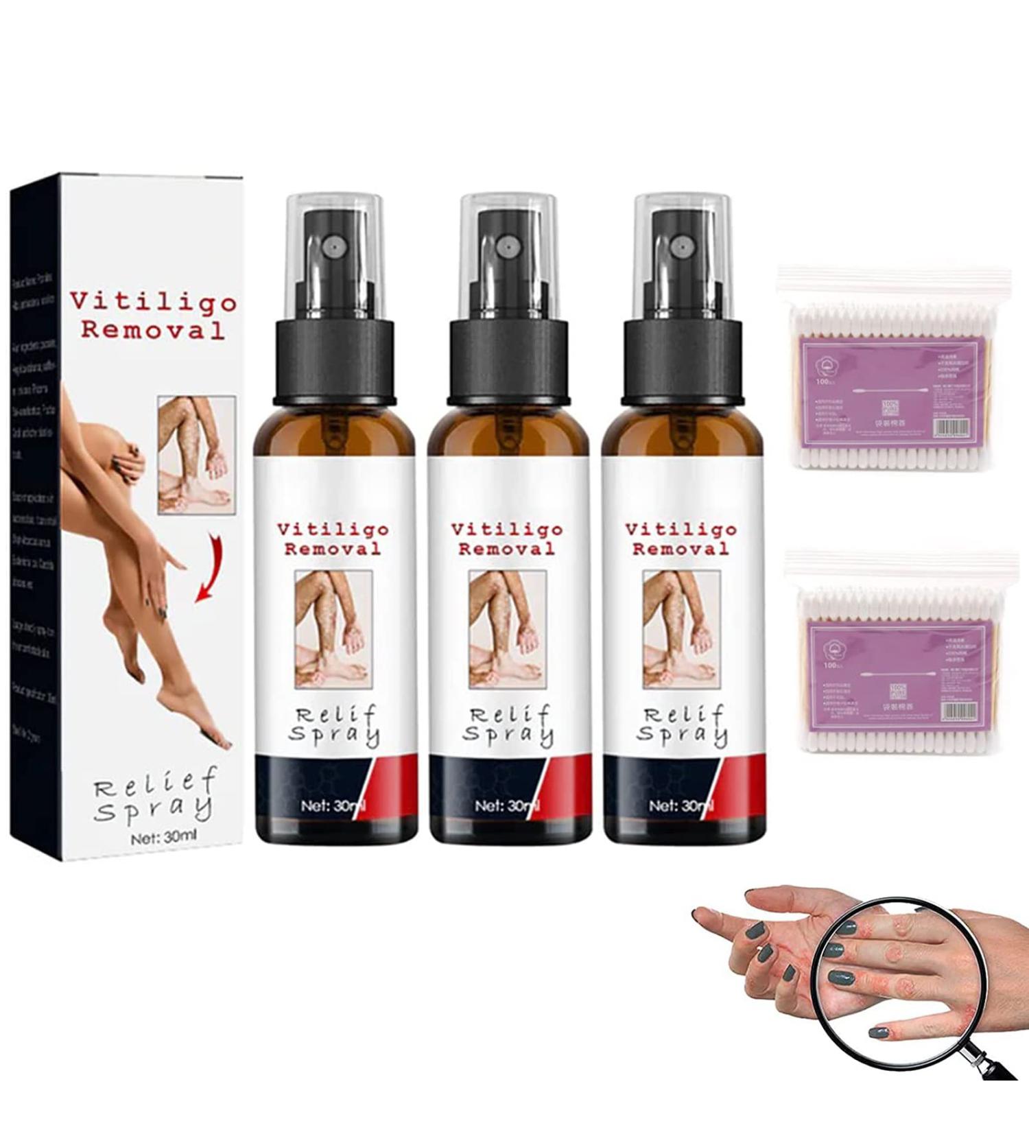 Vitiligo Removal Relief Spray - Skin Repair & Care Treatment for White Spots (3Pcs) - Buy Online on GoSupps.com
