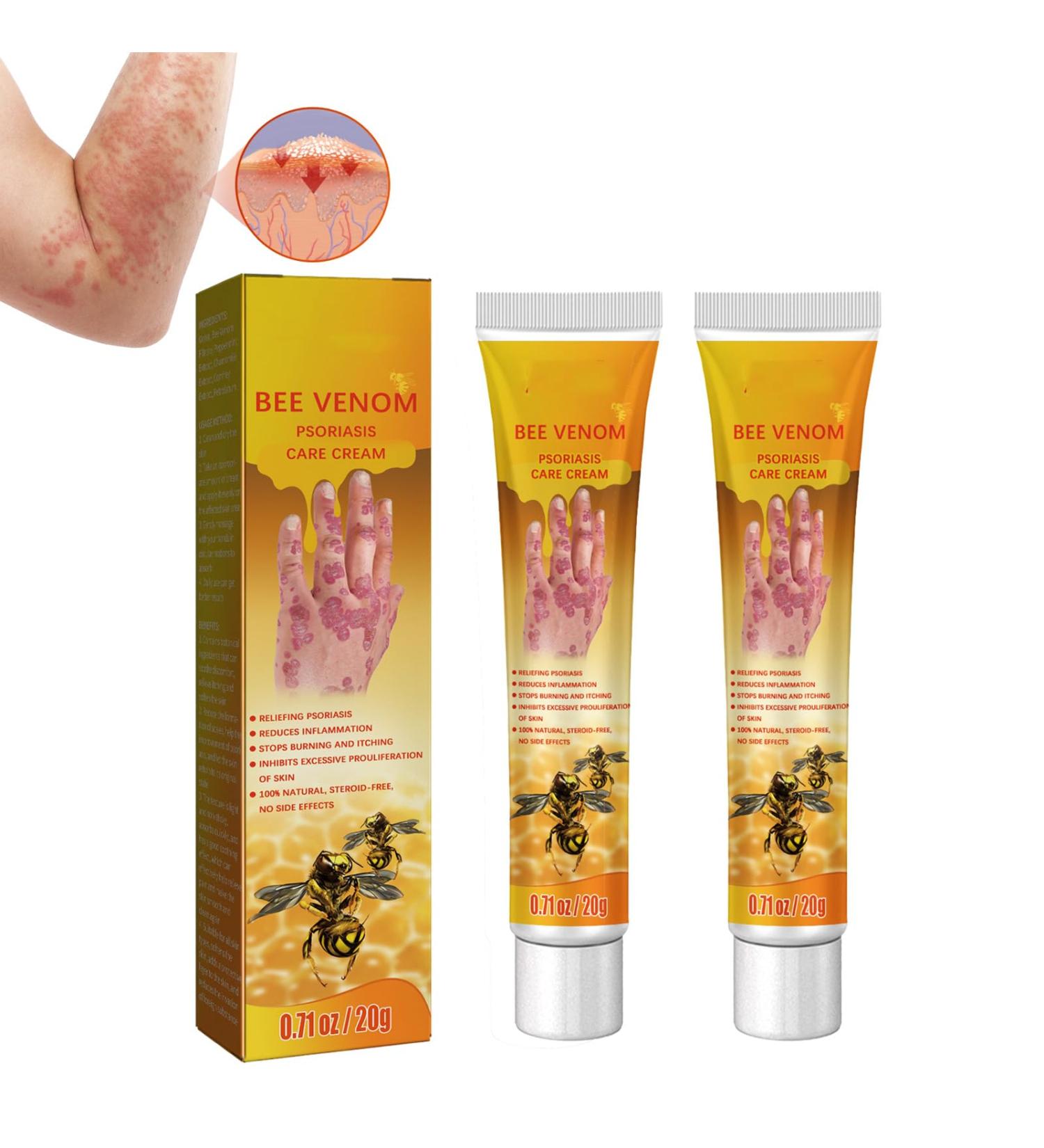 Professional Psoriasis Treatment Cream with New Zealand Bee Venom - Soothing and Moisturizing Formula for Youthful Skin (2pcs) - Buy Online on GoSupps.com