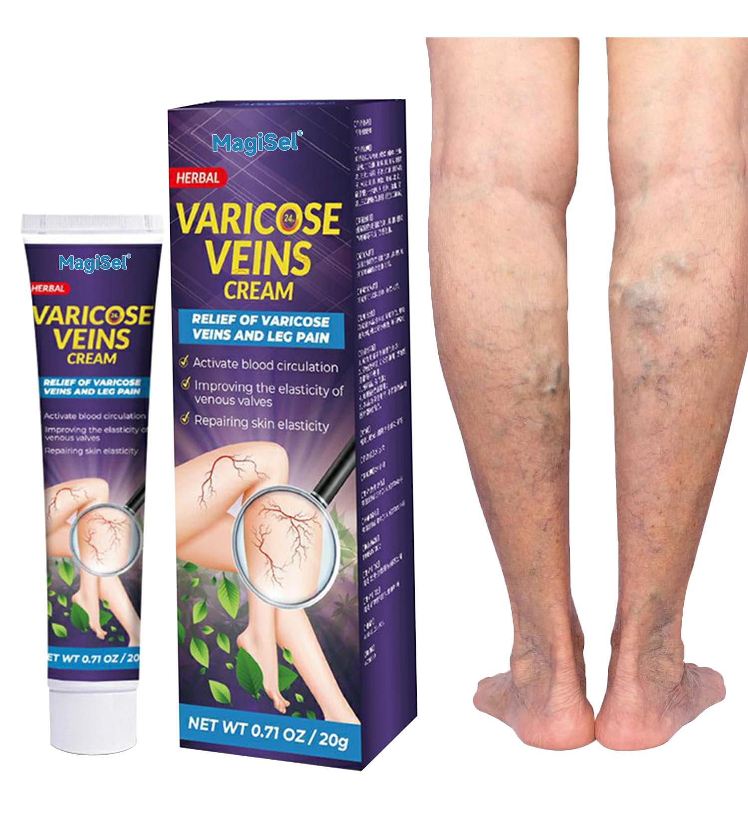  MagiSel Varicose Vein Cream Varicose Vein Cream Cream for Varicose Veins Varicose Vein Leg Treatment Suitable for Spider Veins Improves Blood Circulation Quickly Relieves Tired Legs 20g - Buy Online on GoSupps.com