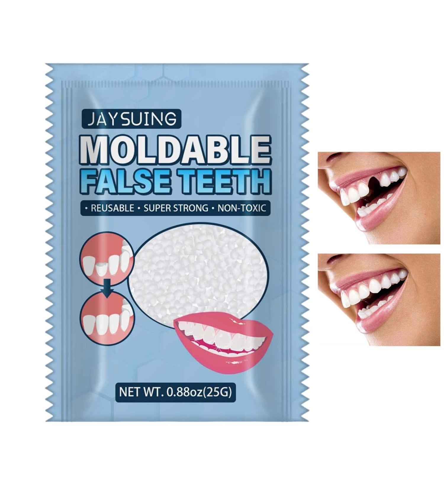 Virtcooy Temporary Tooth Repair - Thermal Pearls for Broken Teeth & Denture Adhesive | Fast International Shipping - Buy Online on GoSupps.com