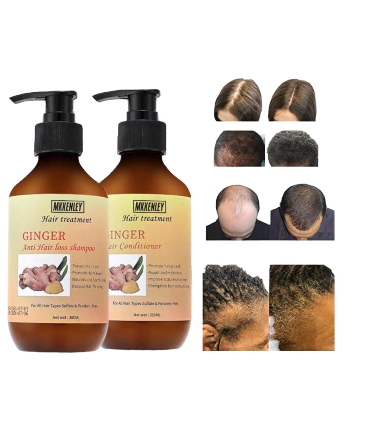 MKKENLEY Ginger Anti Hair Loss Shampoo & Conditioner Set - Hair Growth Treatment for Men & Women - Nourishes Scalp, Promotes Hair Regrowth - 300ml - Buy Online on GoSupps.com