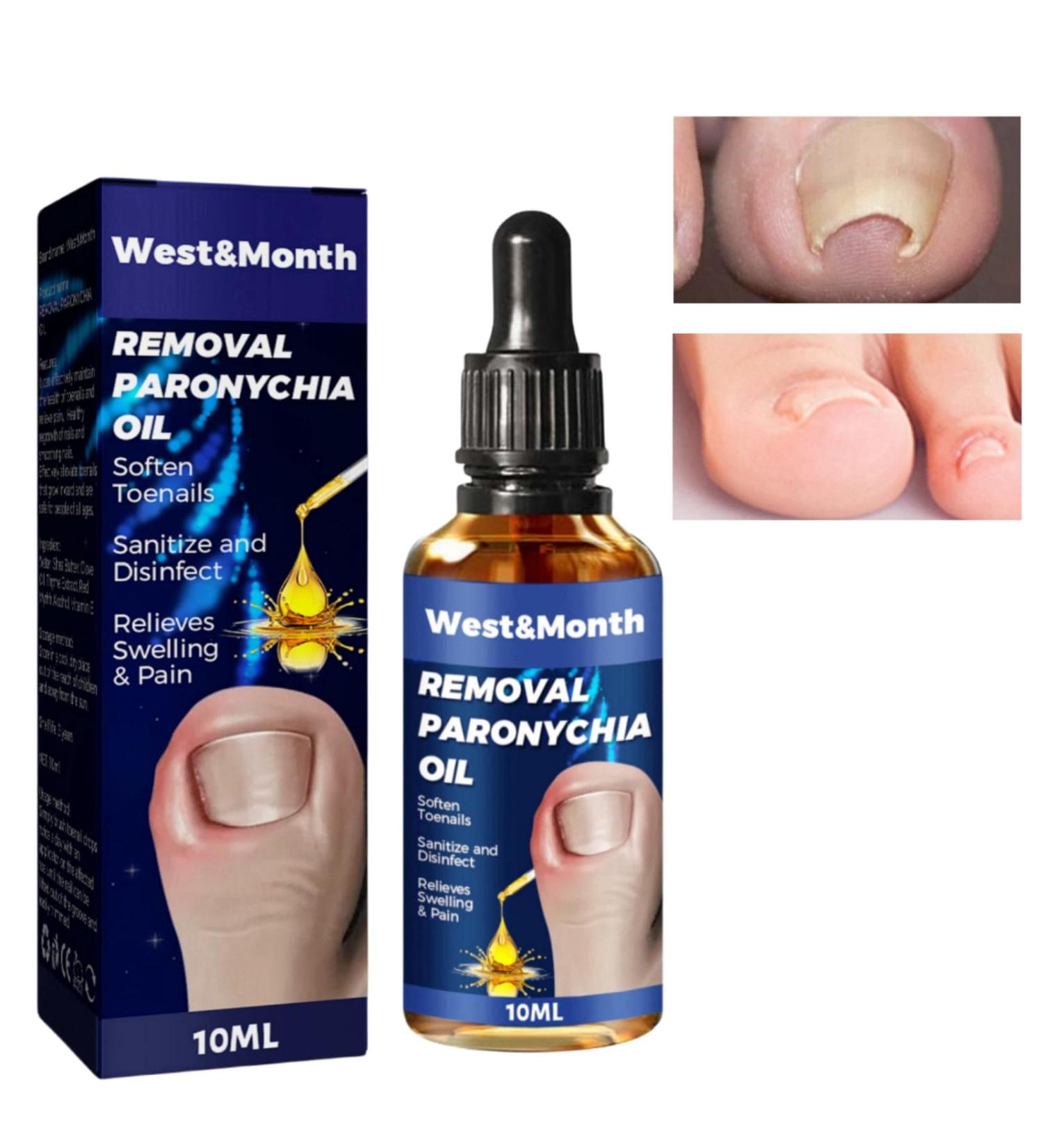 Ingrown Toenail Treatment Oil for Thick, Damaged Nails - Toenailplus Anti Paronychia Relief - Buy Online on GoSupps.com