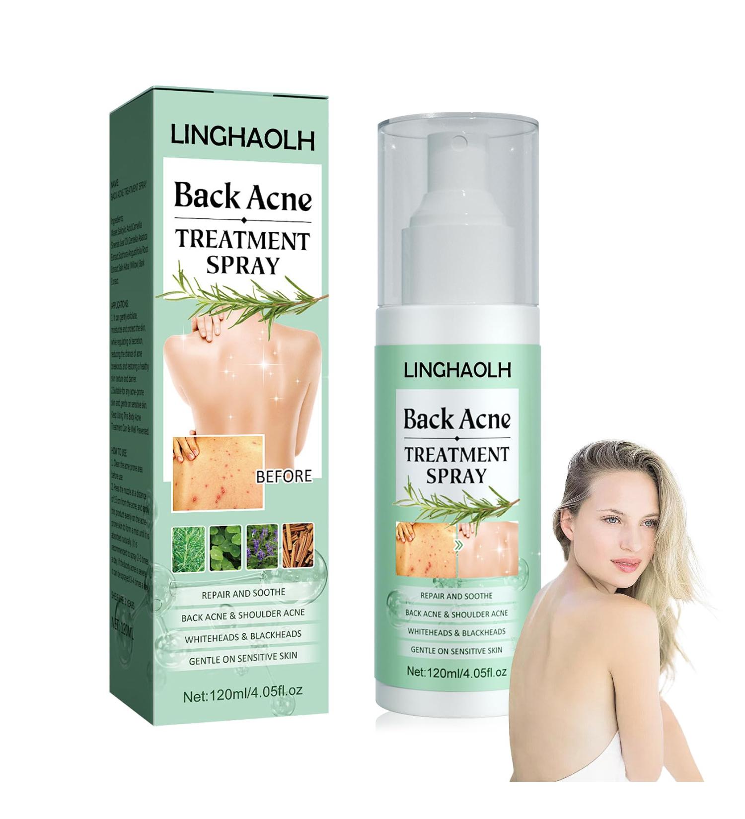 Back Acne Treatment Spray - Moisturizing Body Cleanser for Men & Women | Shop Now for Clear Skin - Buy Online on GoSupps.com