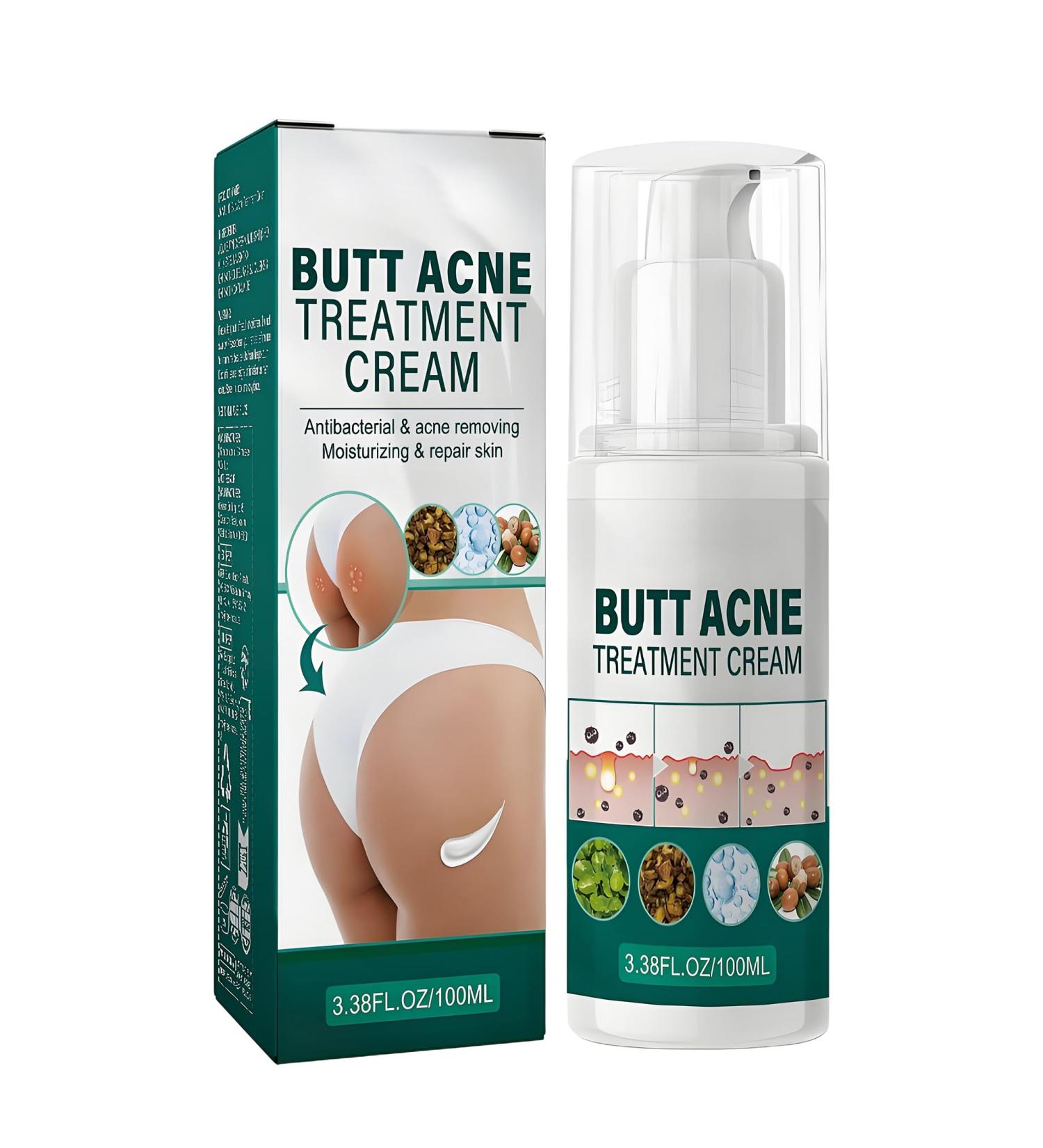 Cr me nettoyante contre l'acn pour les fesses et les cuisses 100 ml de cr me d'acn pour les fesses cr me nettoyante anti-acn cr me anti-boutons sur les fesses limine les boutons et les taches - Buy Online on GoSupps.com