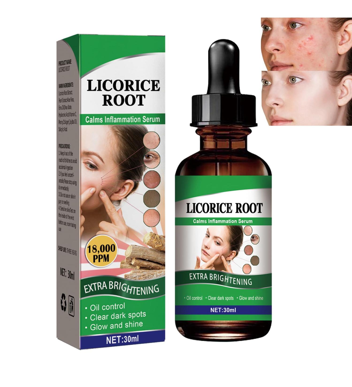 Whitening Rejuvenating Essence Licorice Extract Whitening Essence Women Face Firming Tightening Serum Licorice Extract Wrinkle Removal Essence Moisturizing Fast Absorbing Brightness Bloom Young Skin - Buy Online on GoSupps.com