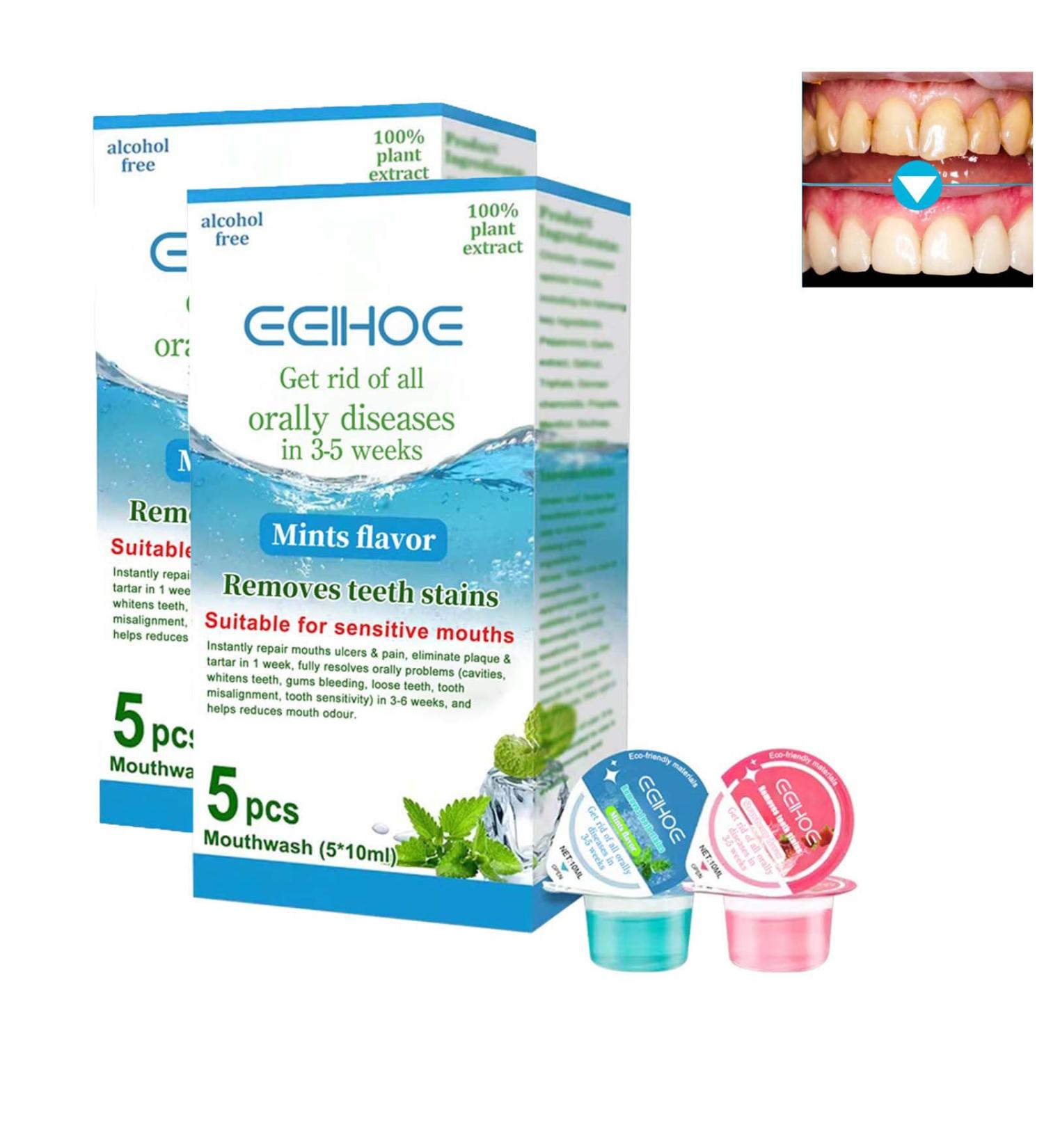 Oralheal Jelly Cup Mouthwash - Fresh Breath & Healthy Teeth | 10 Pack - International Shipping - Buy Online on GoSupps.com