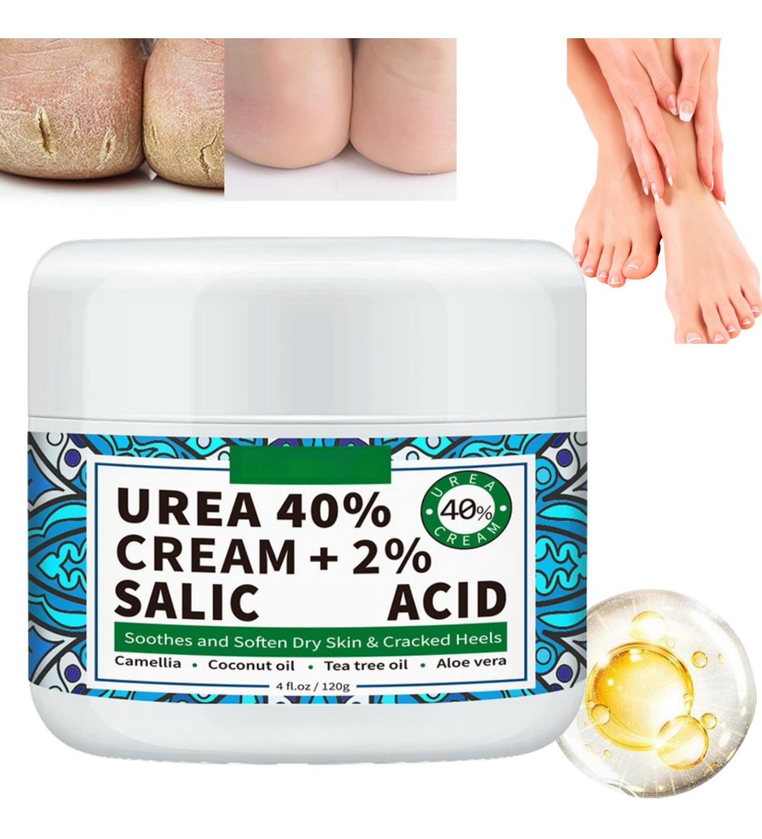 Urea 40% Foot Cream Foot Cream for Cracked Heels and Dry Skin Moisturizing Cracked Heel Repair Cream for Feet and Hand Cracked Heel Repair Cream Foot Moisturiser Urea Cream Heel Balm for Cracked Heel - Buy Online on GoSupps.com