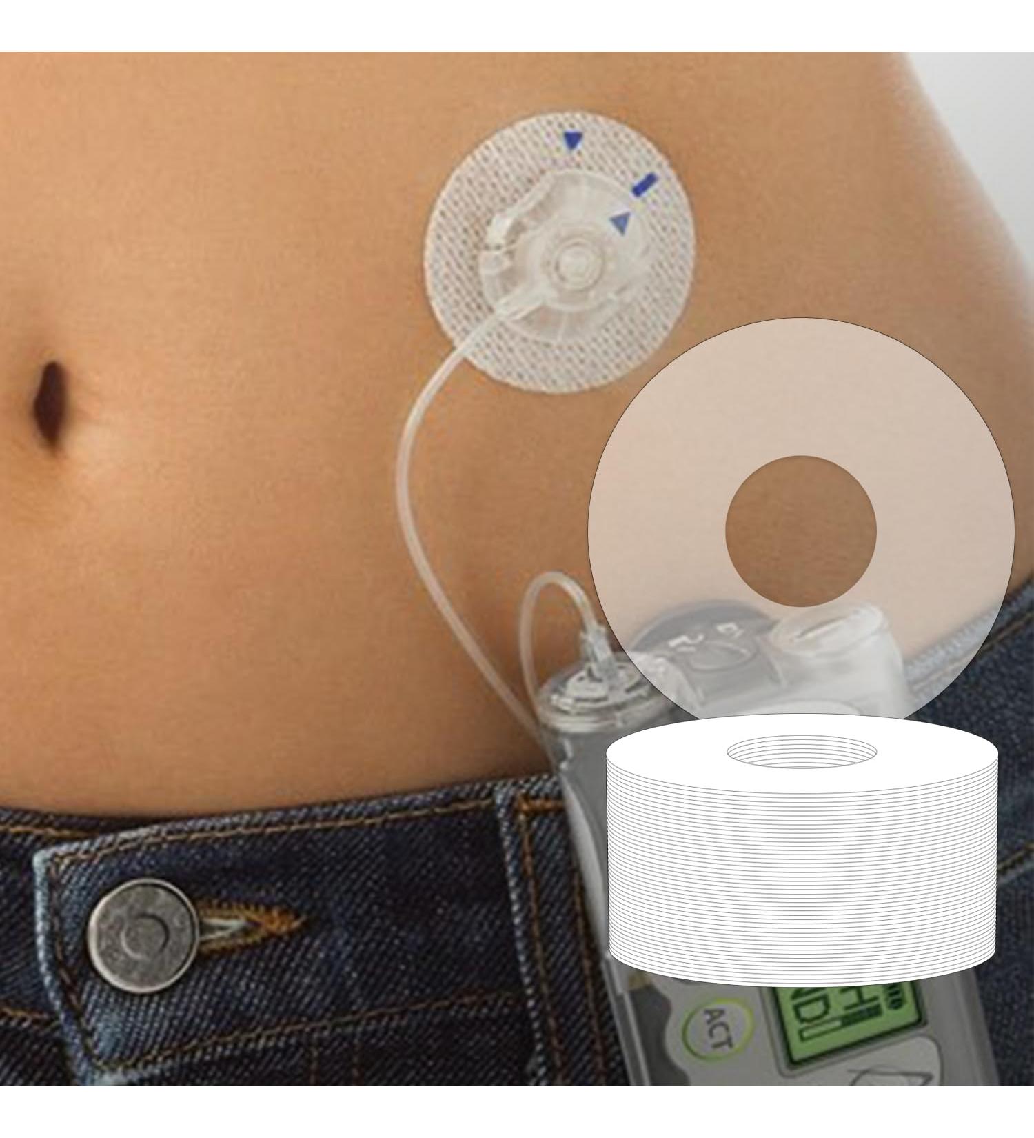 Universal Adhesive Patches for CGM & Insulin Pumps | Waterproof Clear Skin-Friendly | 40 Pack - Lasts 10-14 Days - Buy Online on GoSupps.com