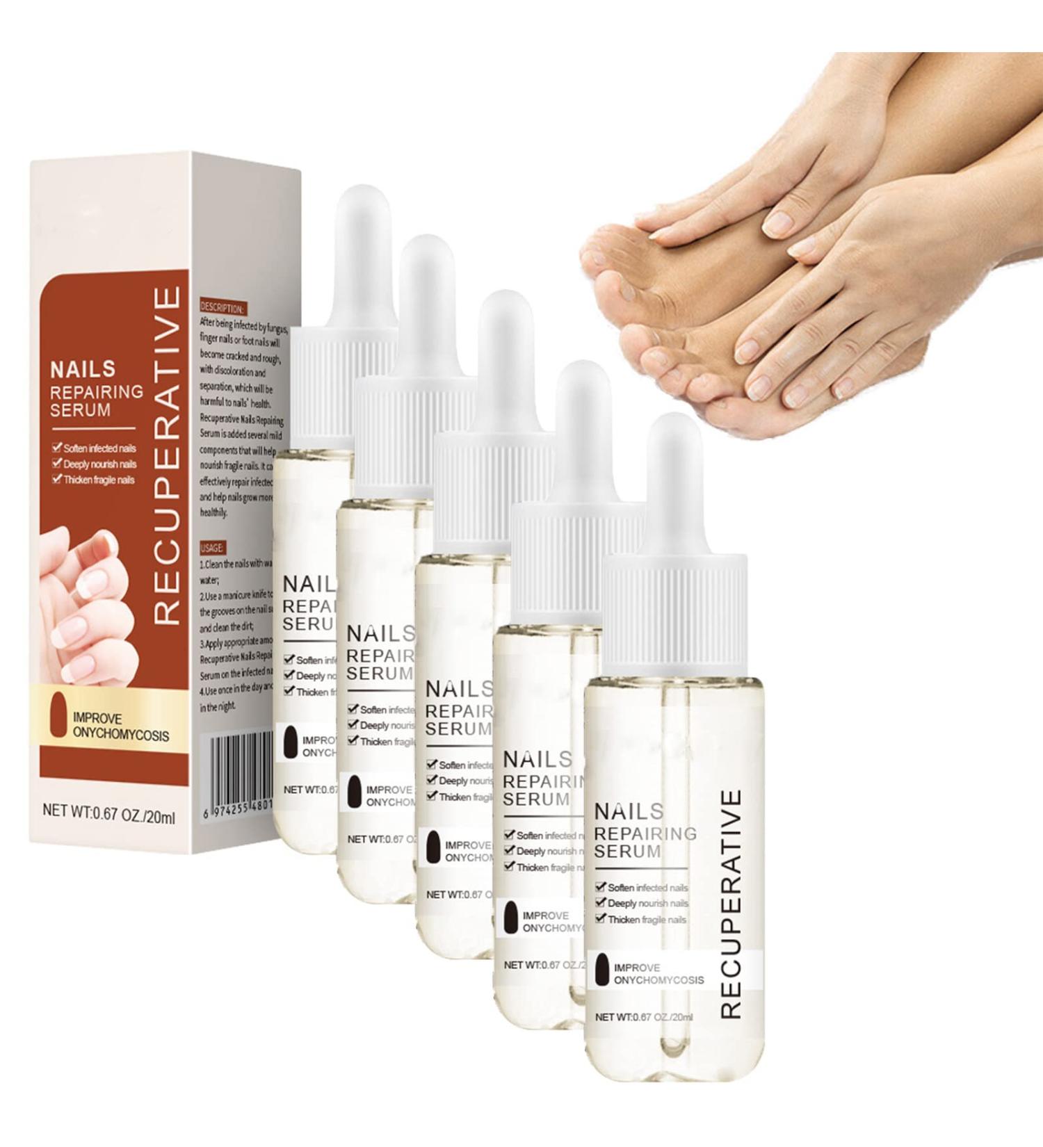 7 Days Nail Growth and Strengthening Serum 1/2/3/5 bottles Nail Strengthener and Growth Serum (5 bottles) - Buy Online on GoSupps.com